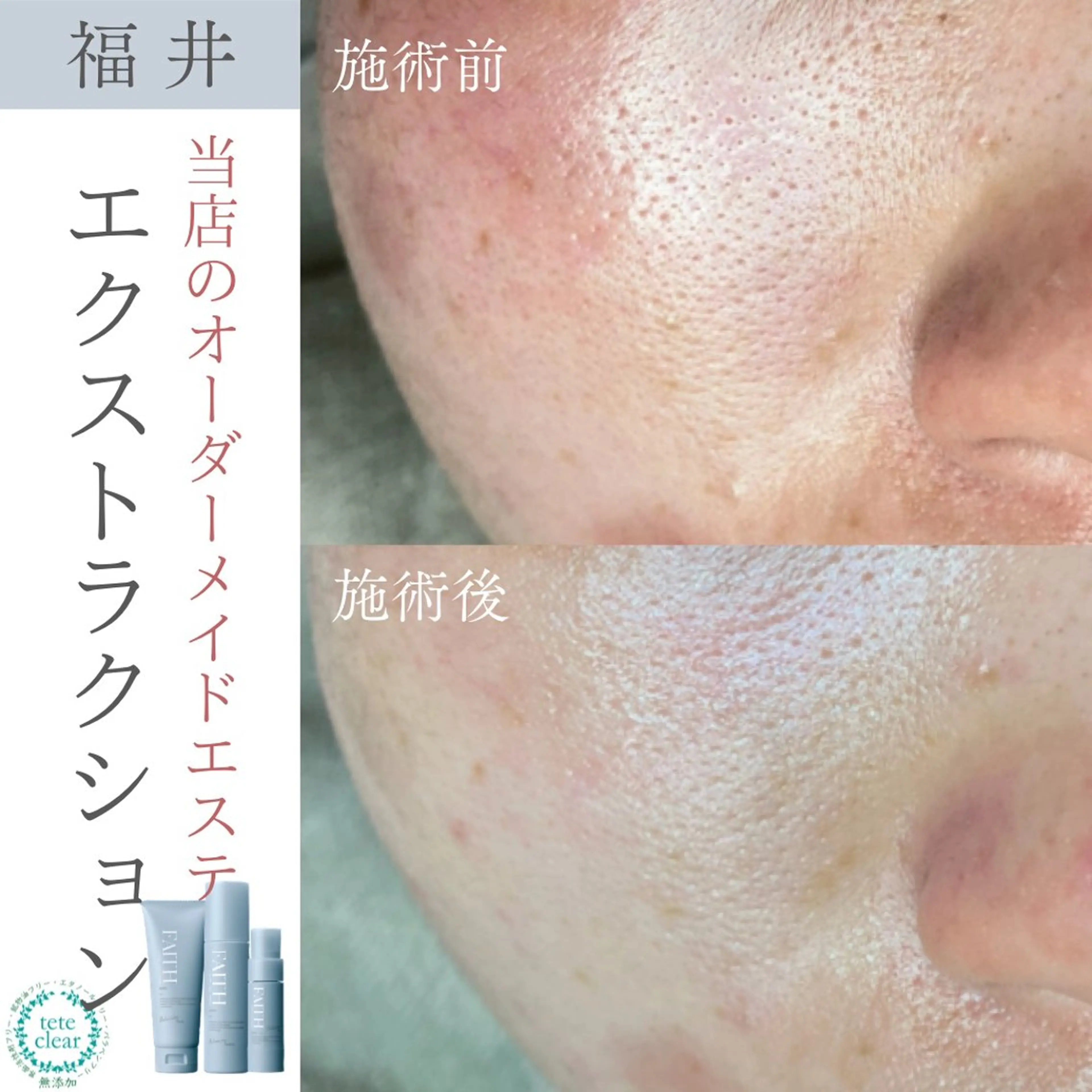 エステ リラク 毛穴肌質ケアサロン Yourmeユアミーのエステ・リラクイメージ