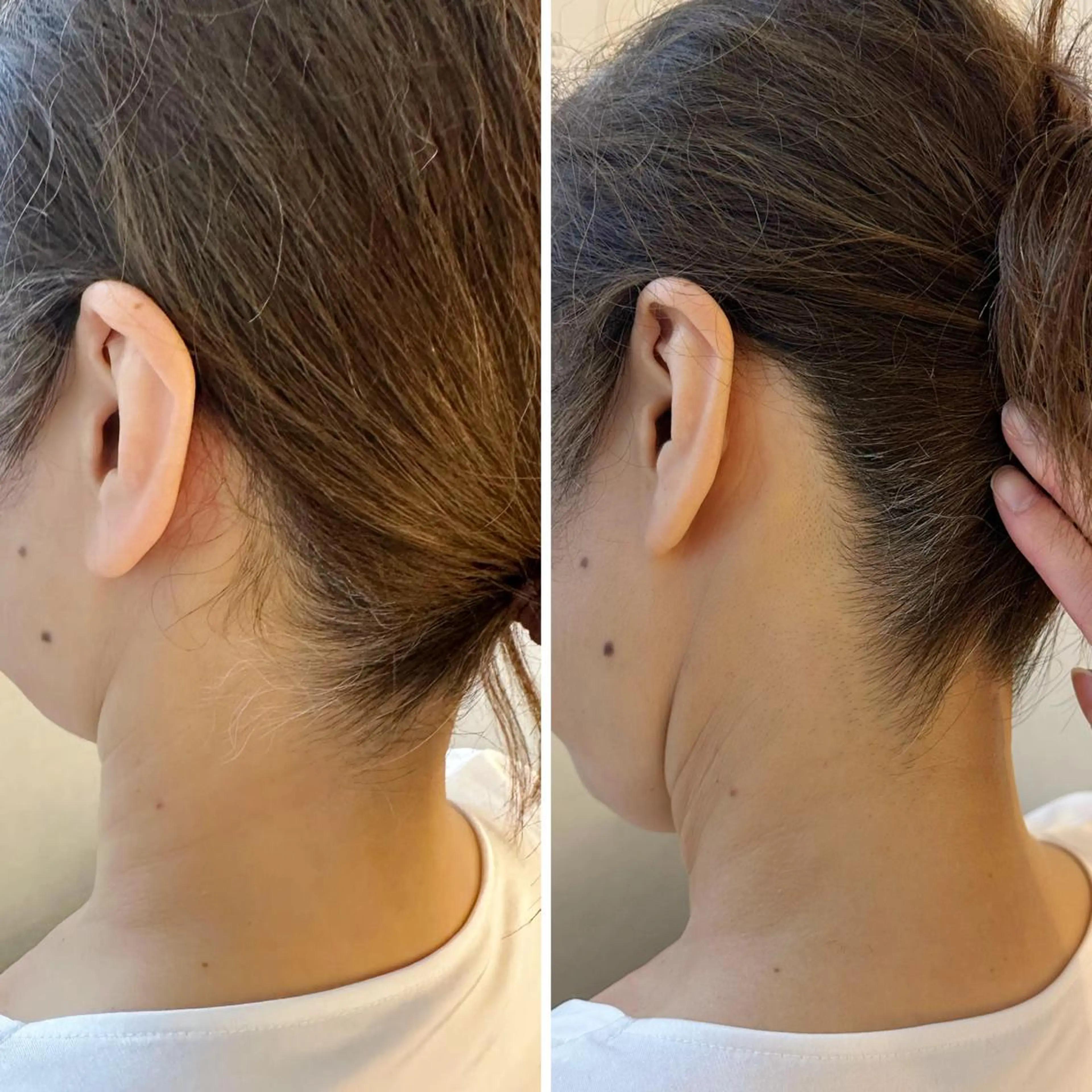 脱毛 うなじ脱毛/美肌脱毛 LABELのエステ・リラクイメージ