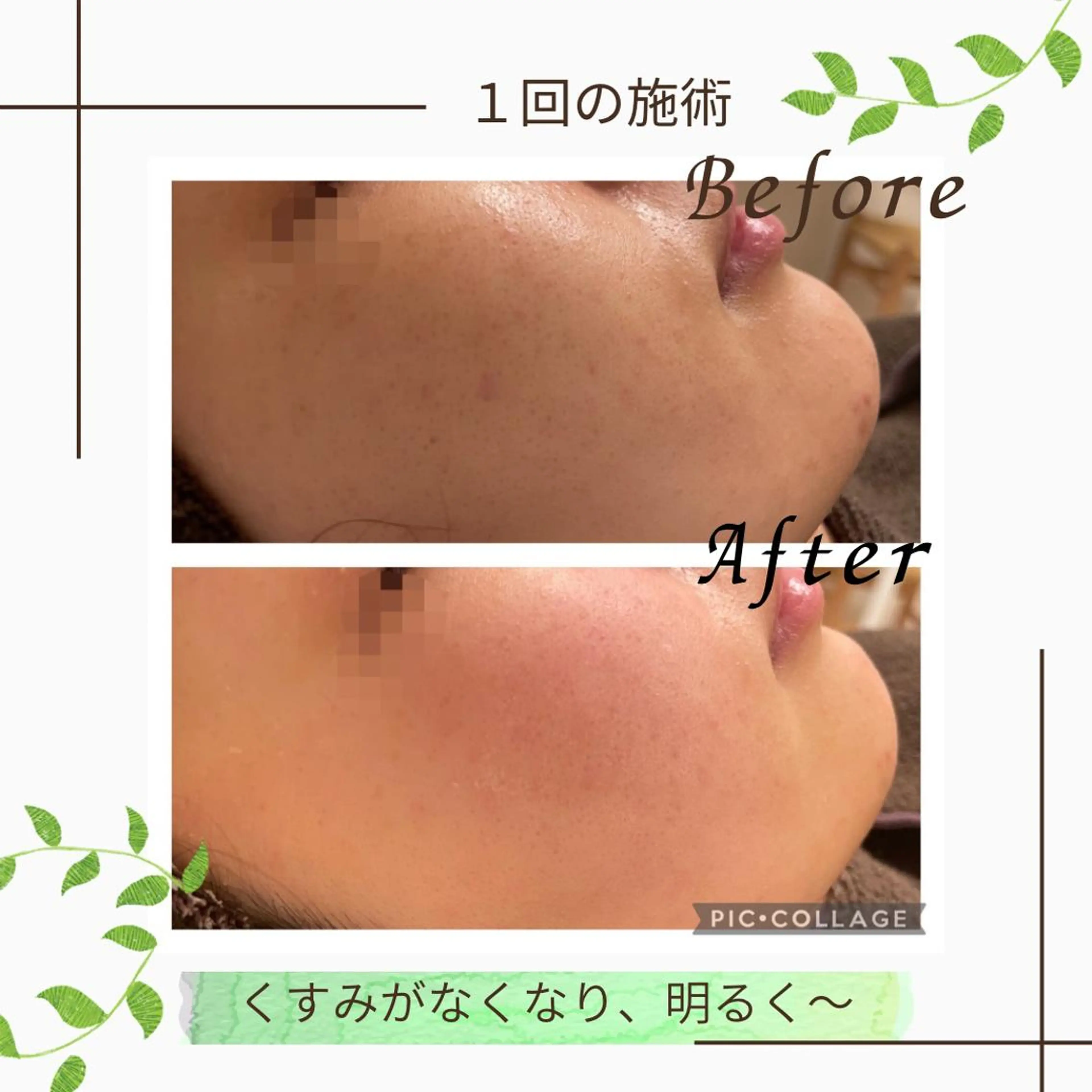 ニキビ改善サロン　縁樹　enju所属・ニキビ専門サロン縁樹 鈴木真樹のエステ・リラクイメージ