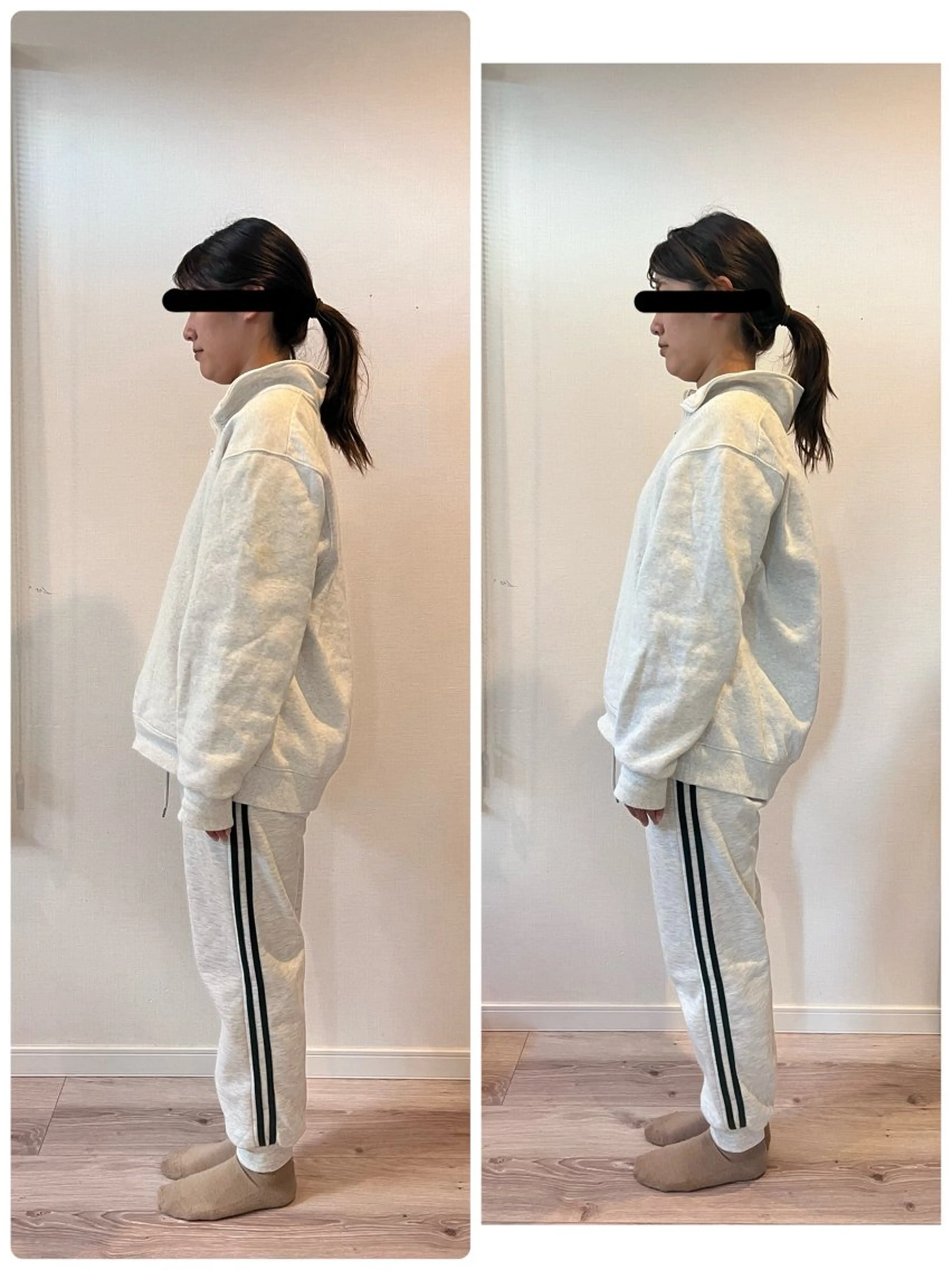 カイロプラクティックの写真