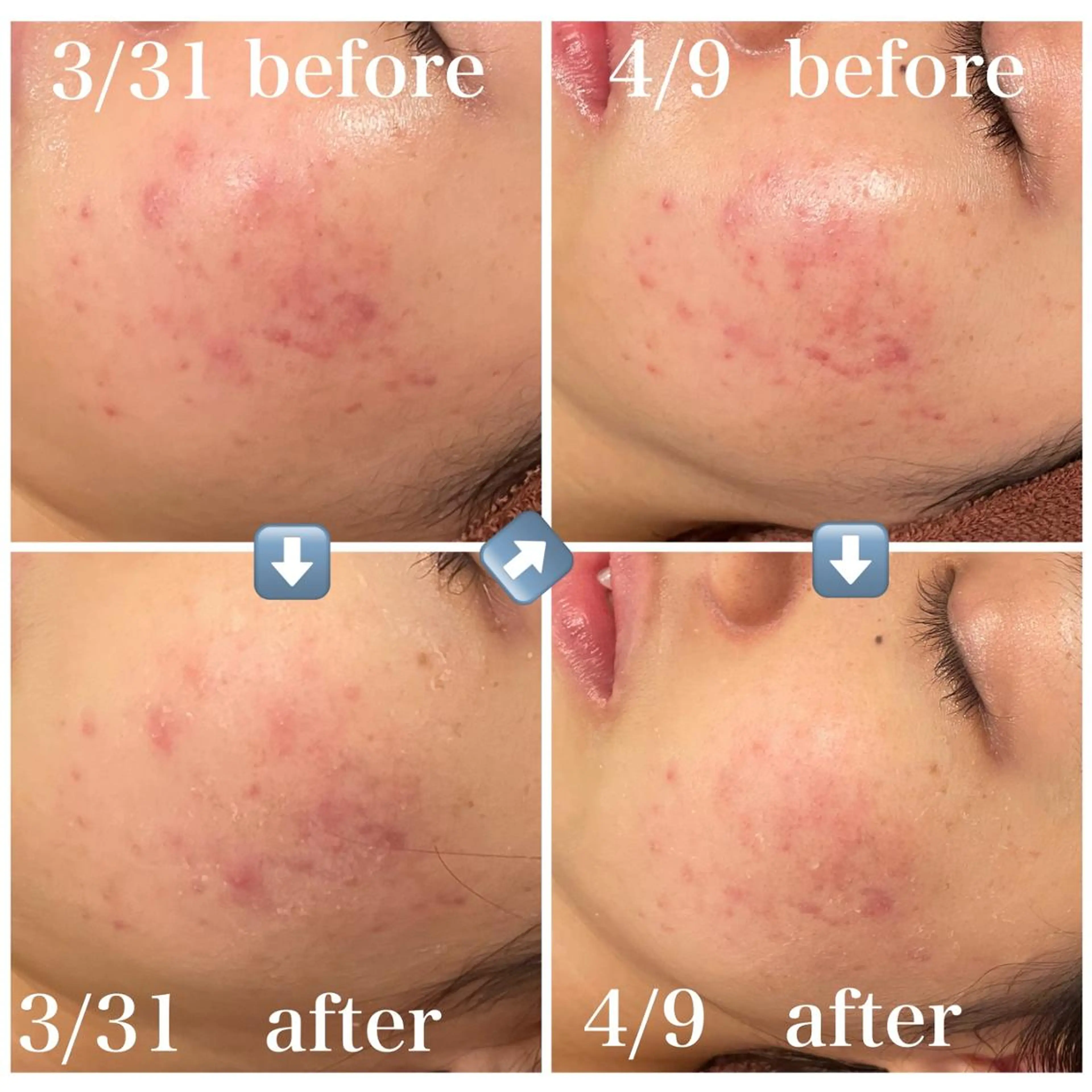 エステ リラク 触れたくなる モテ肌へ...❤︎のエステ・リラクイメージ