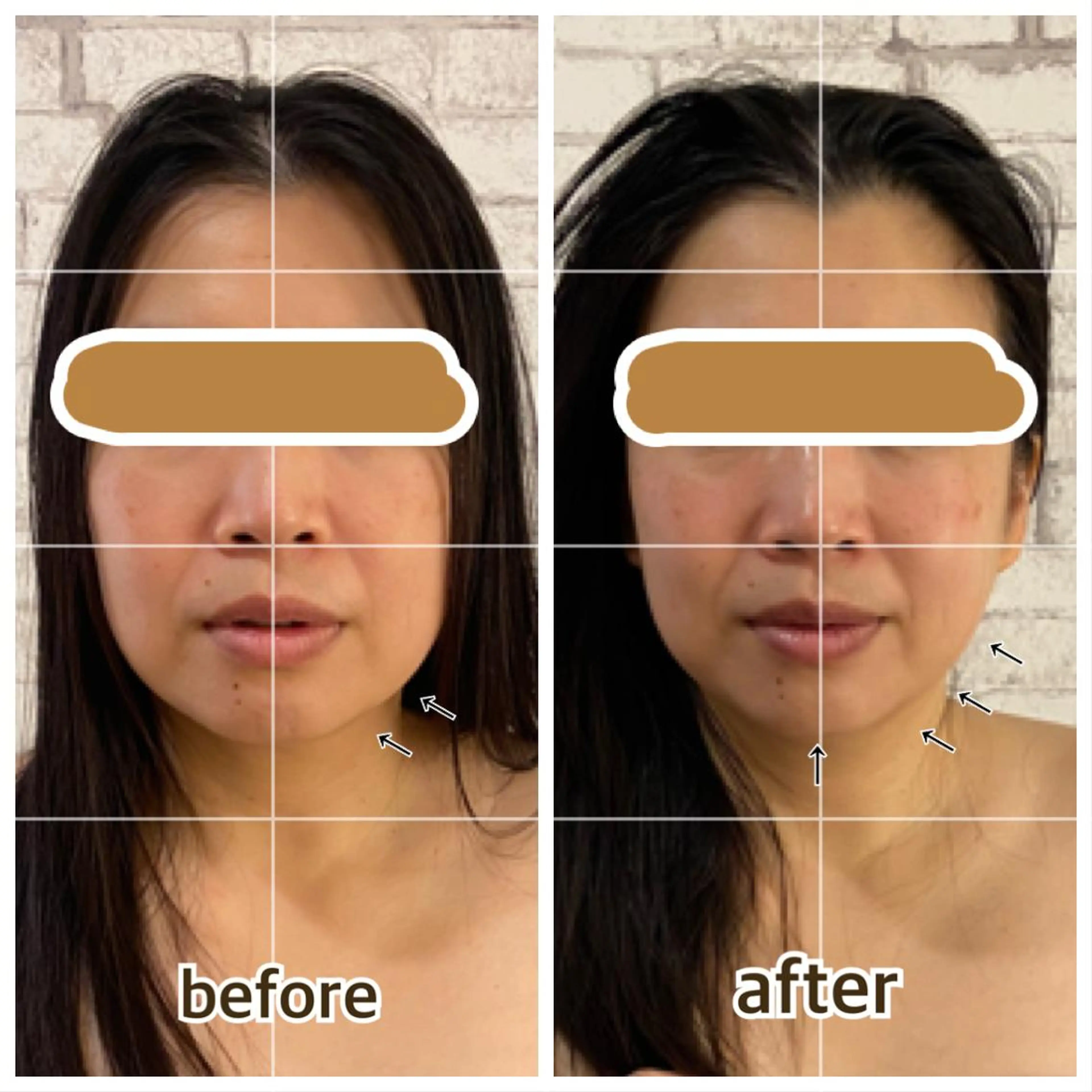 salon ace所属・【小顔矯正】 salonaceのエステ・リラクイメージ