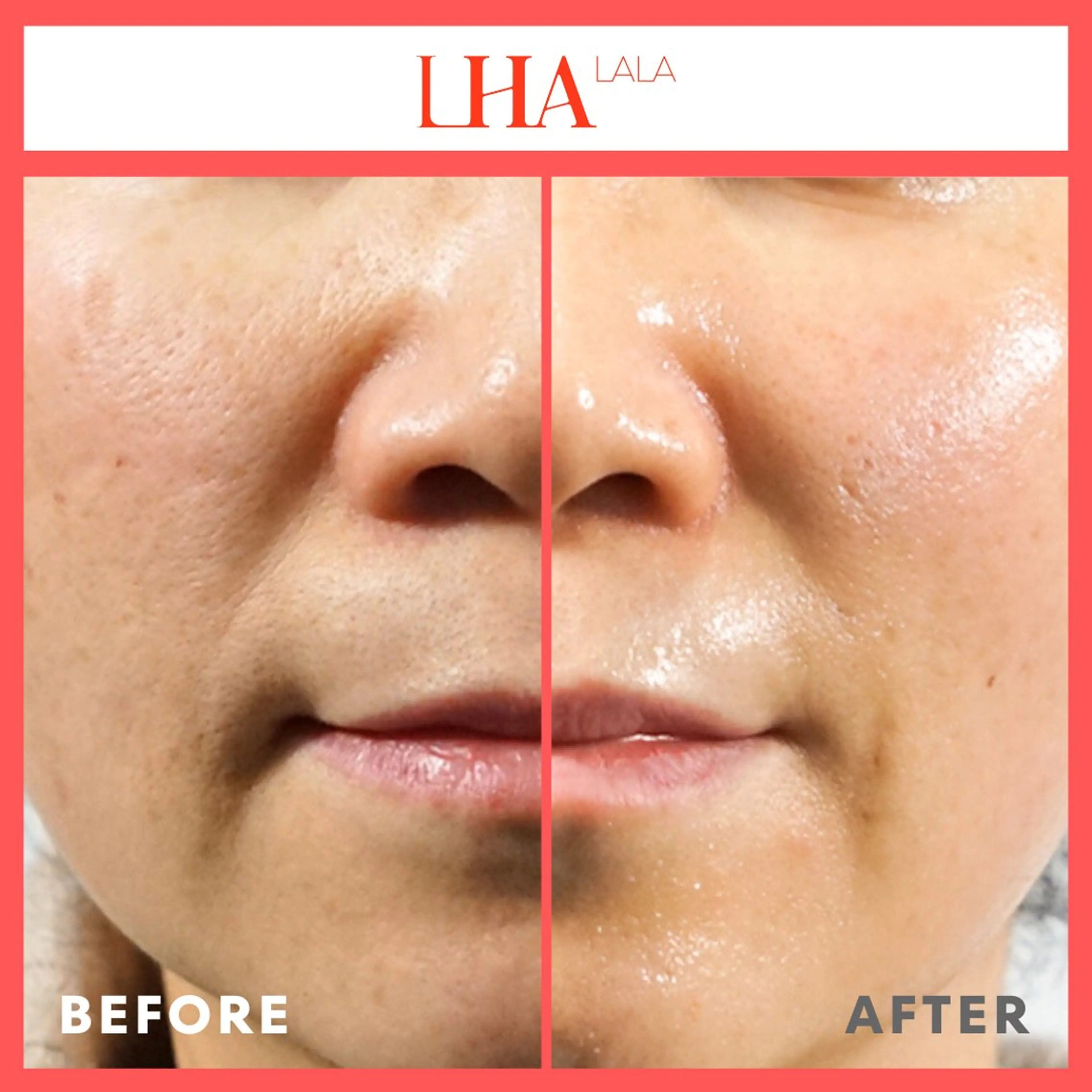 アンチエイジングGYM水素911所属・水素GYM911 美容のエステ・リラクイメージ