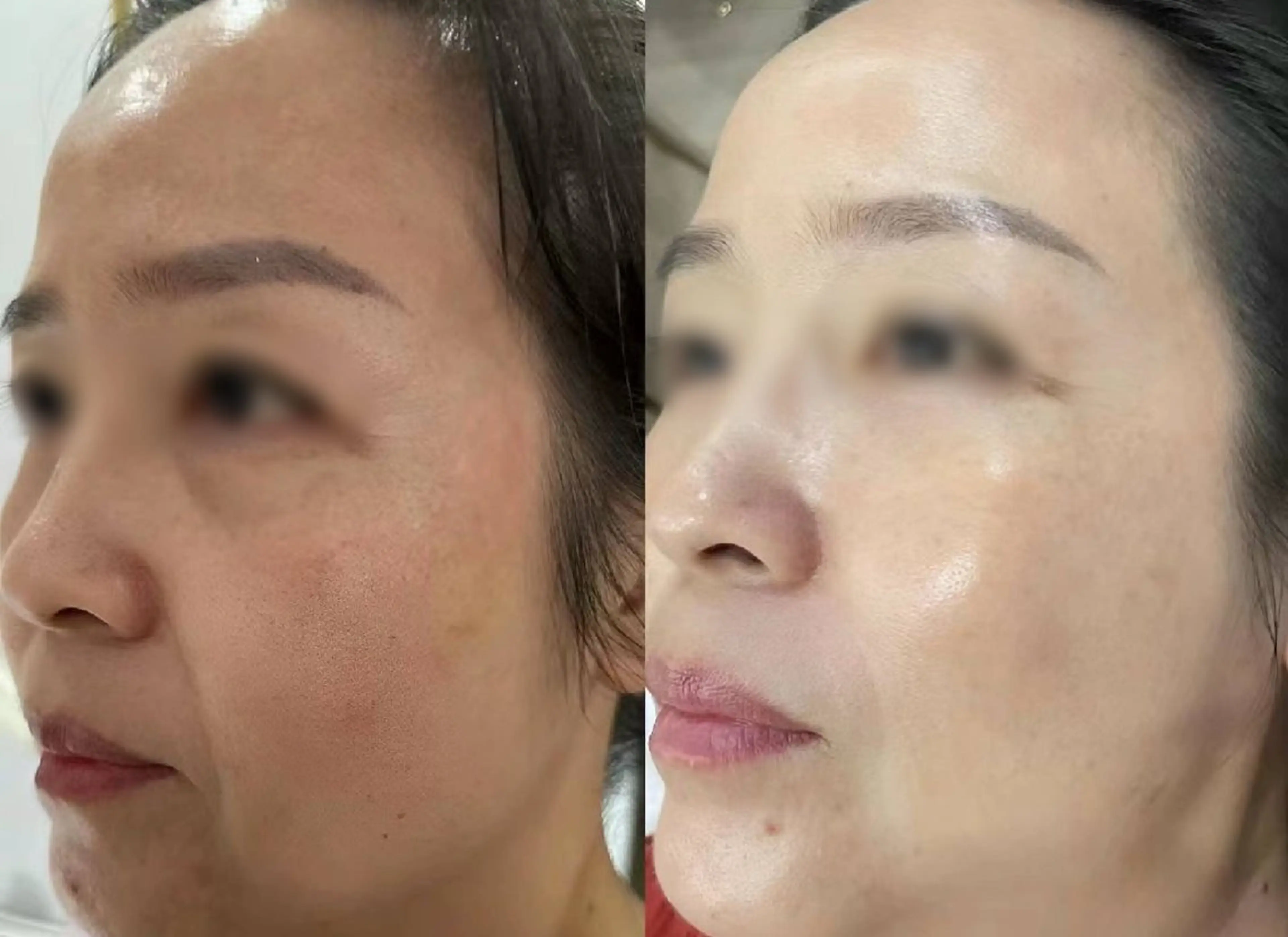 エステ aliaハイフ&水光ジェットサロン所属・aliaハーブ水光店 エステティシャン募集のエステ・リラクイメージ