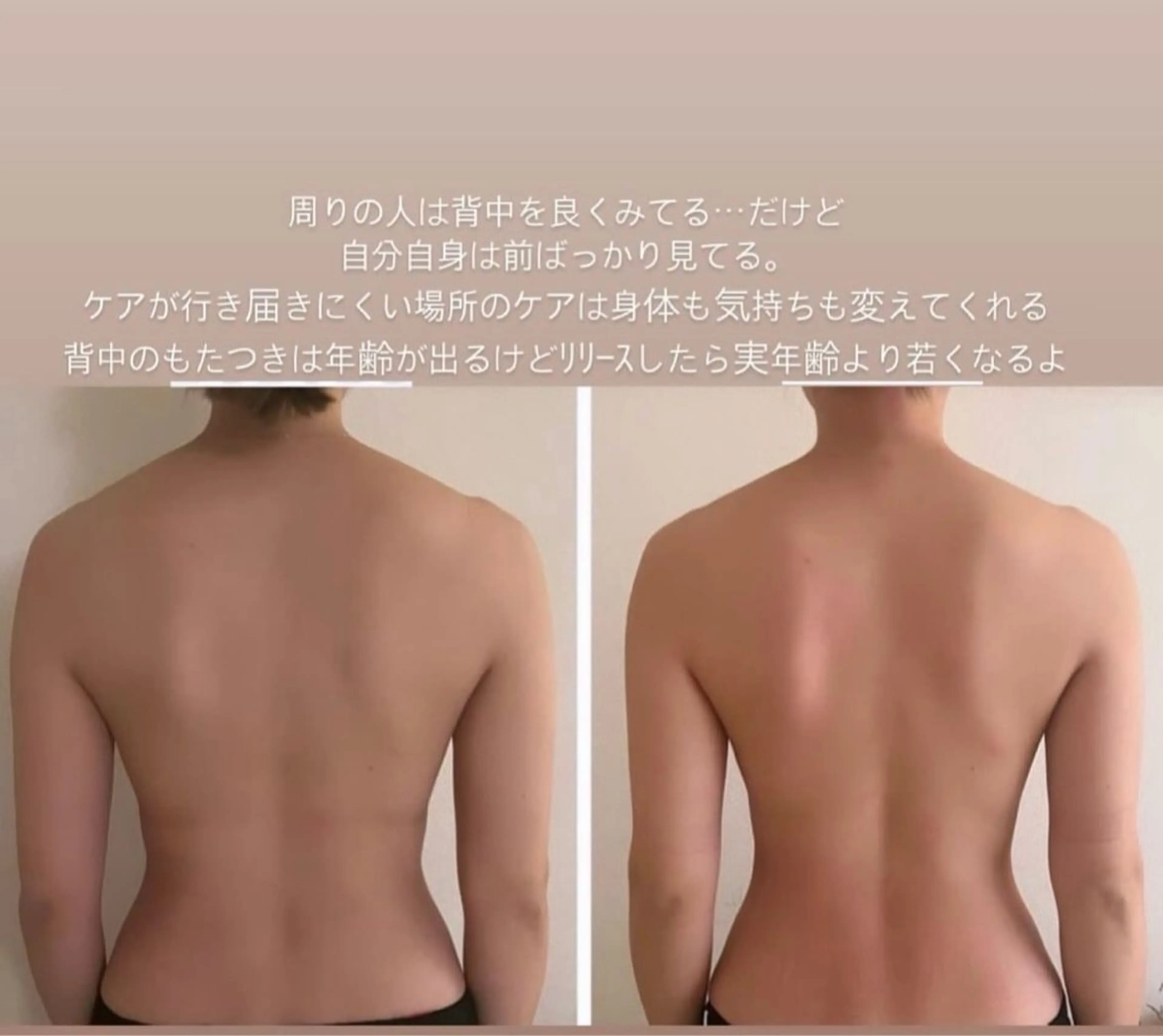 ■ 美ﾎﾞﾃﾞｨ美骨痩身ｺﾙｷﾞorﾊﾞｽﾄ筋膜ﾘﾘｰｽ 45分Back fat and muscle massageの写真