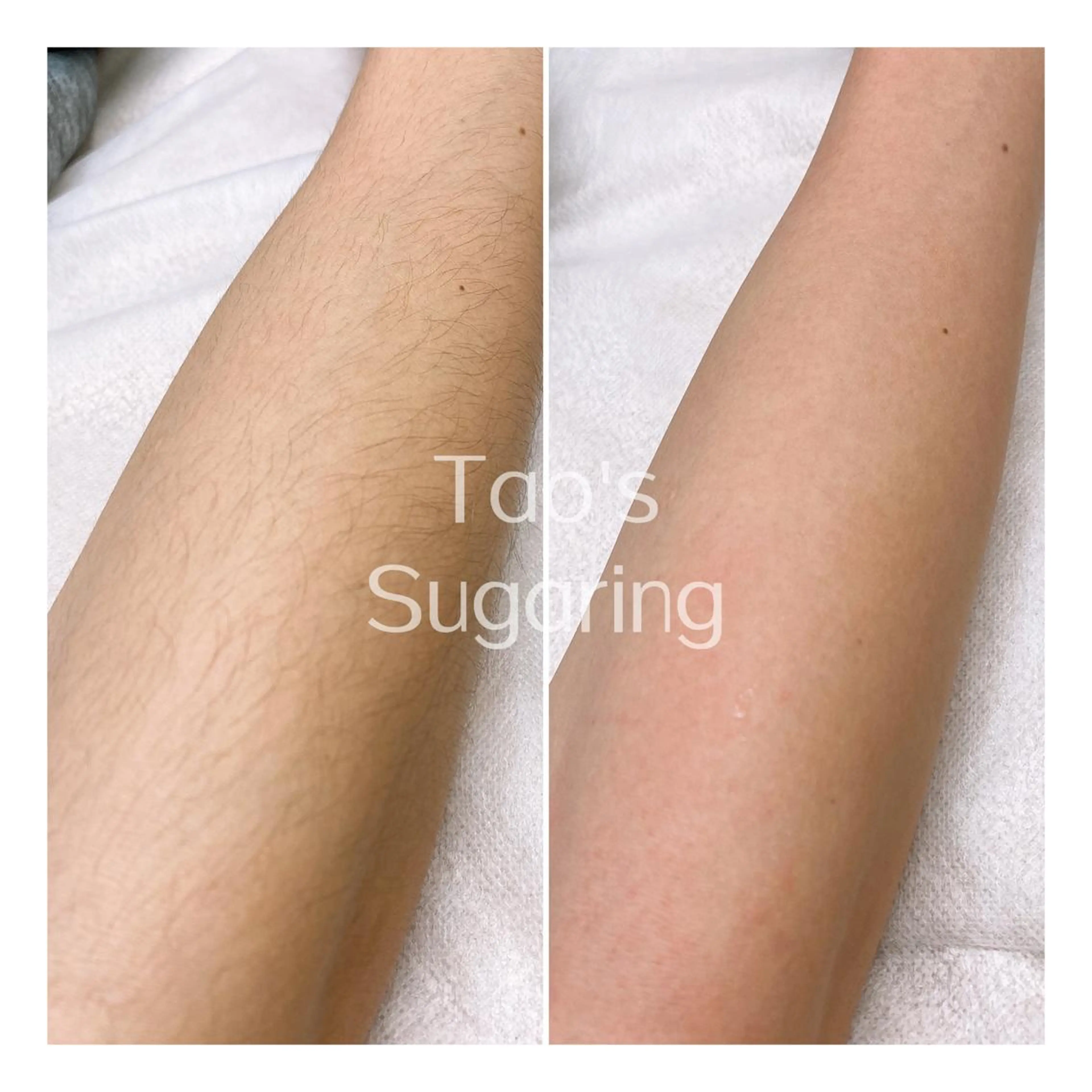 Sugaring / HILOT TAOのエステ・リラクイメージ