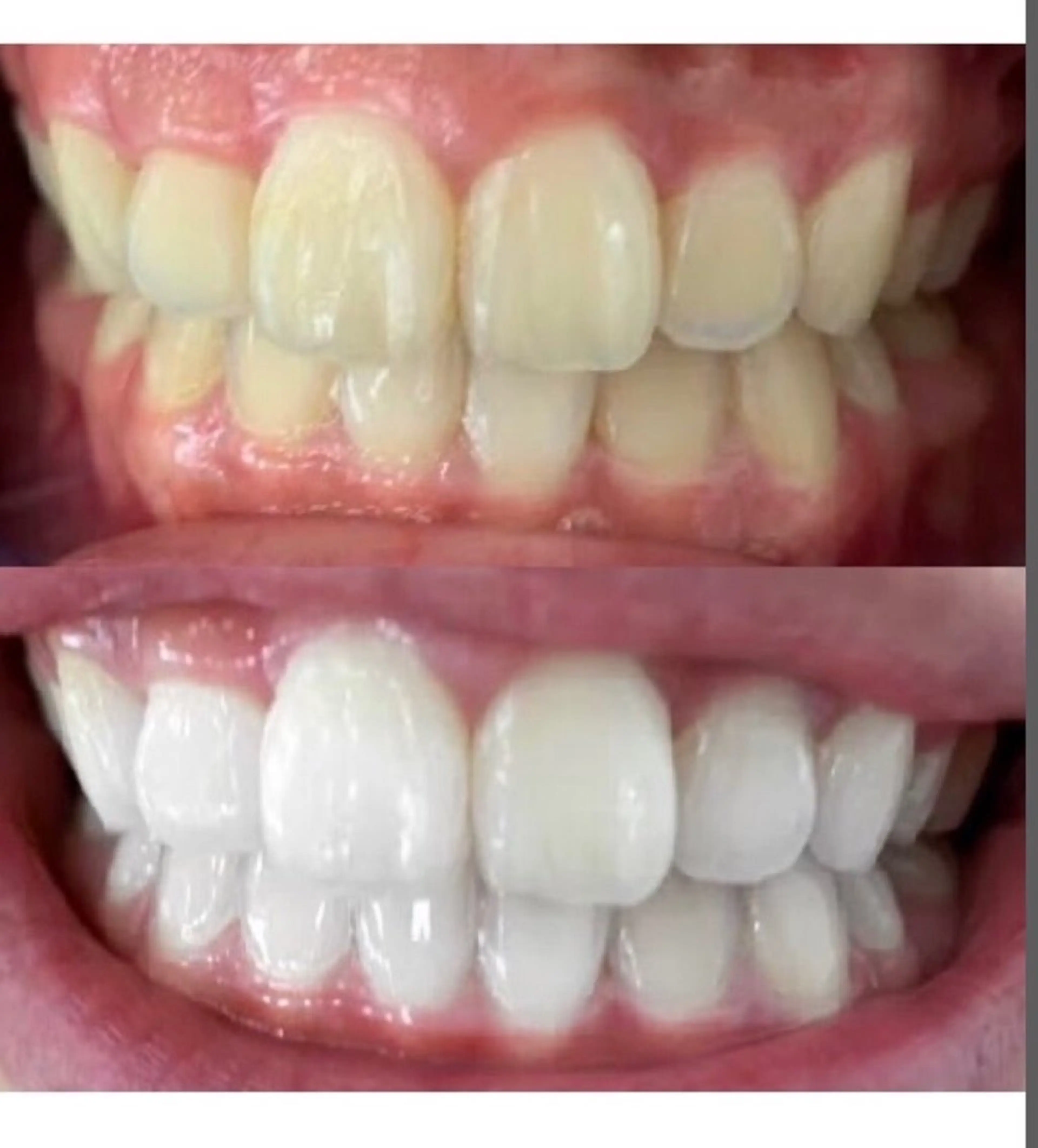 エステ エクシアホワイト 立川南口のエステ・リラクイメージ