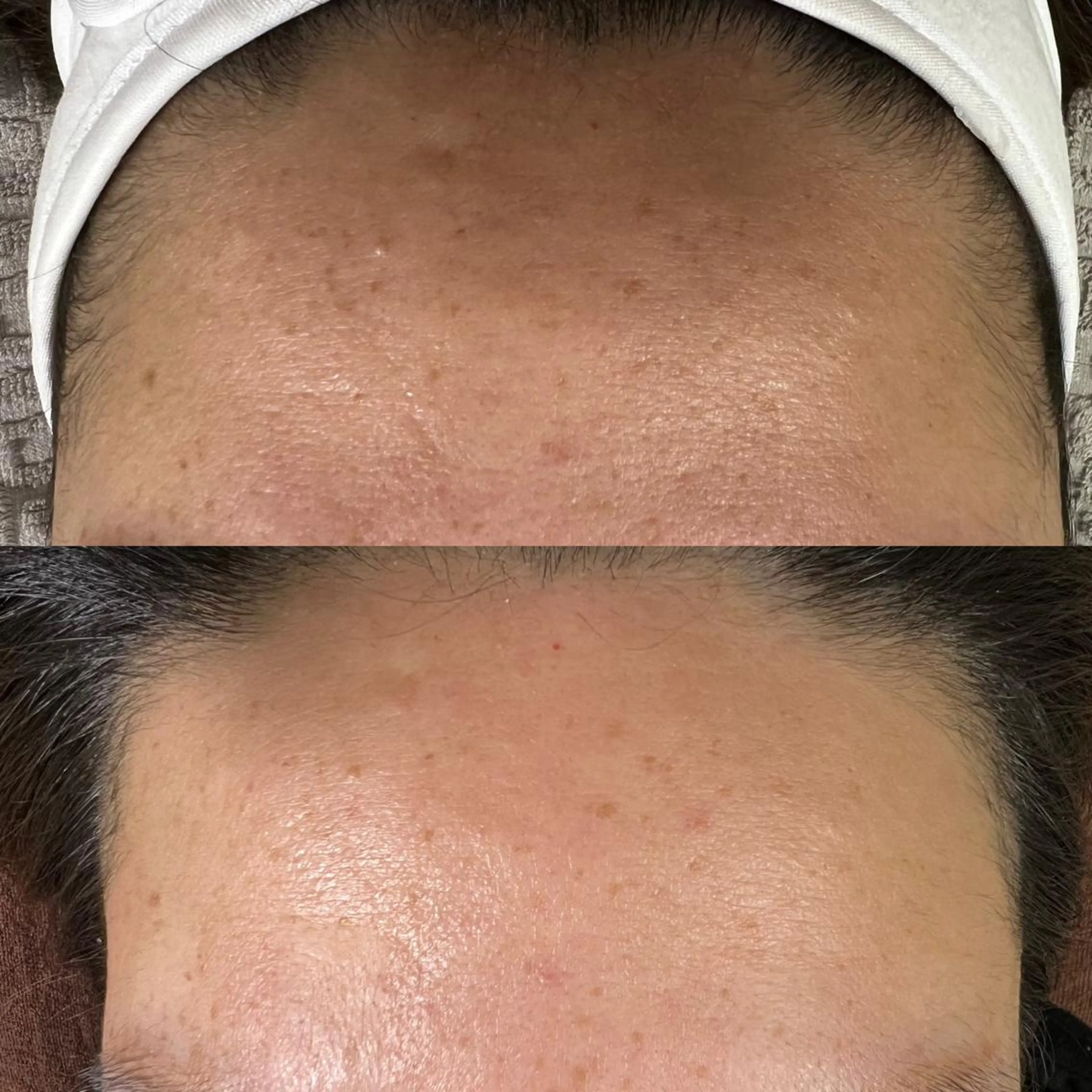 脱毛 ran cocochiのマツエク・マツパデザイン