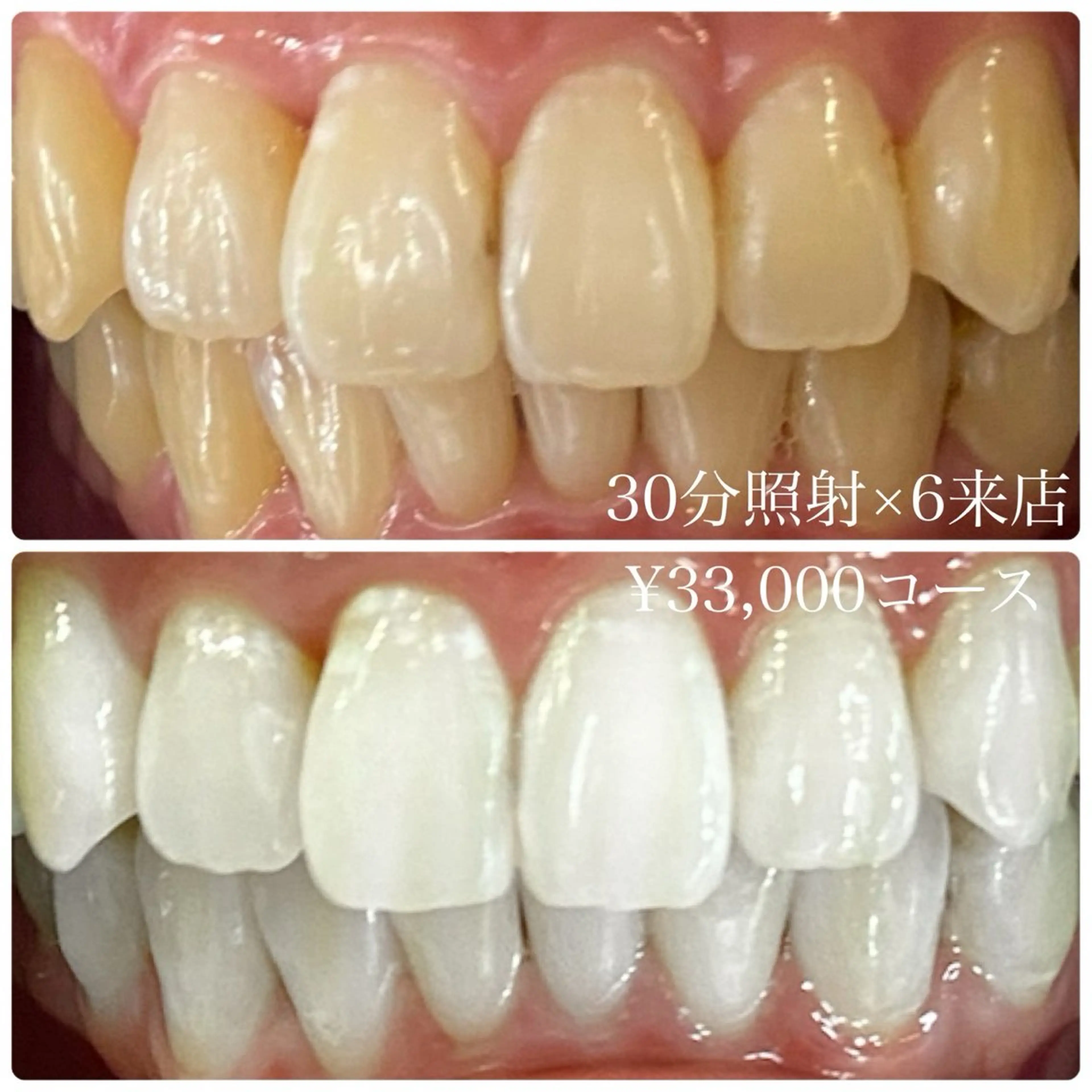 PLATINUM Beauty 横浜店所属・ホワイトニングルーム 横浜店のその他イメージ