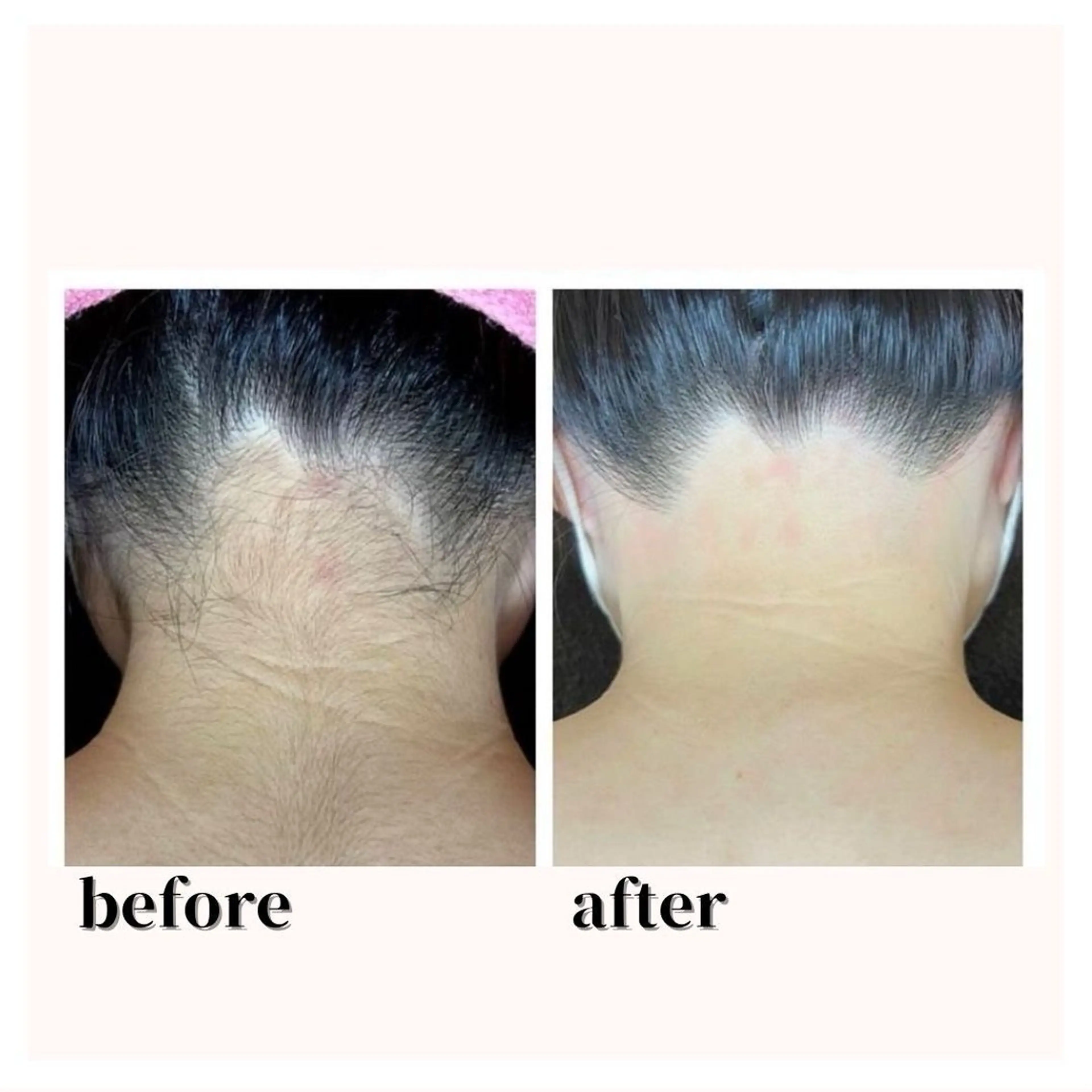 脱毛 脱毛エステサロンViViPirina所属・軽部 歩のエステ・リラクイメージ