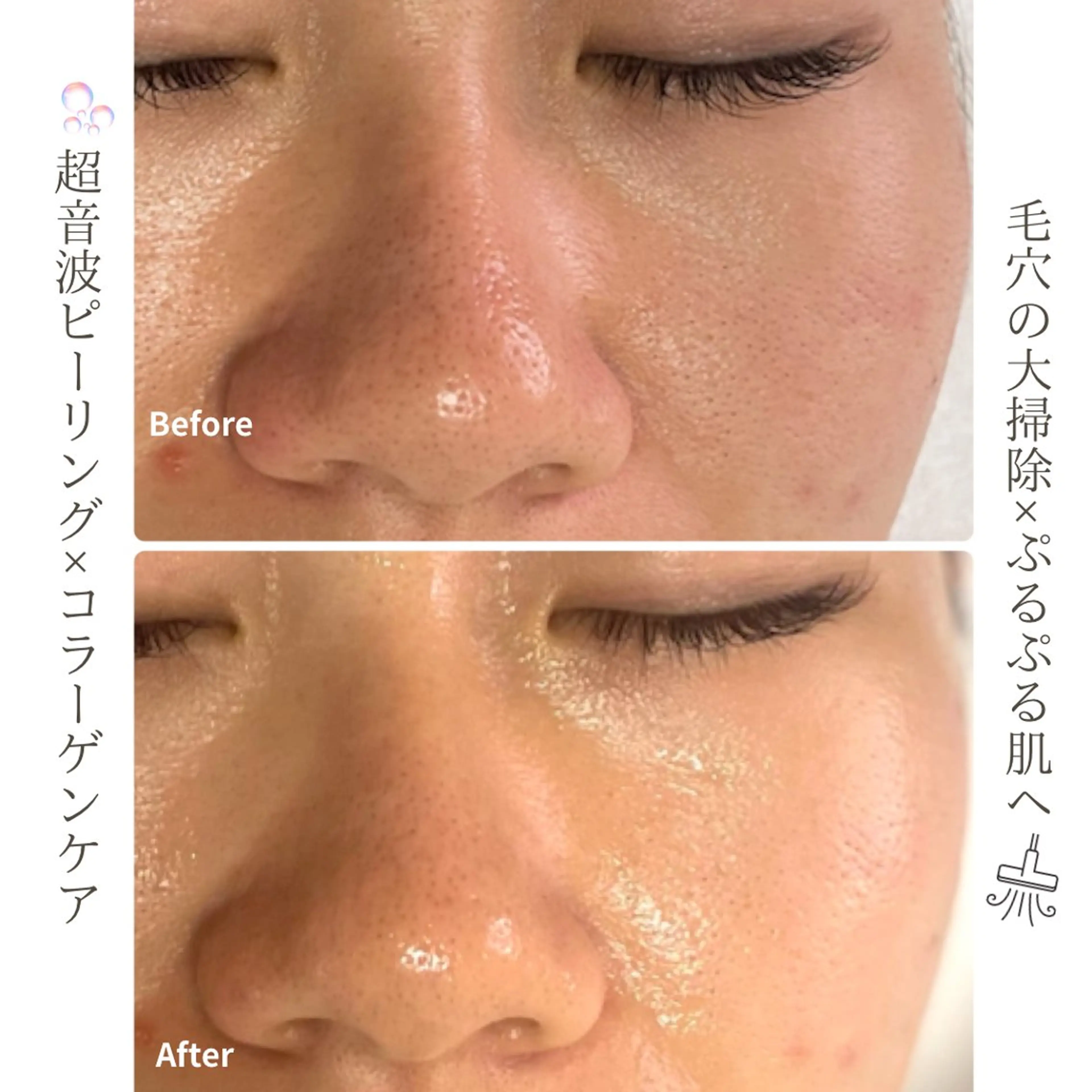 エステ 姫路/肌質改善 /やまもとのエステ・リラクイメージ