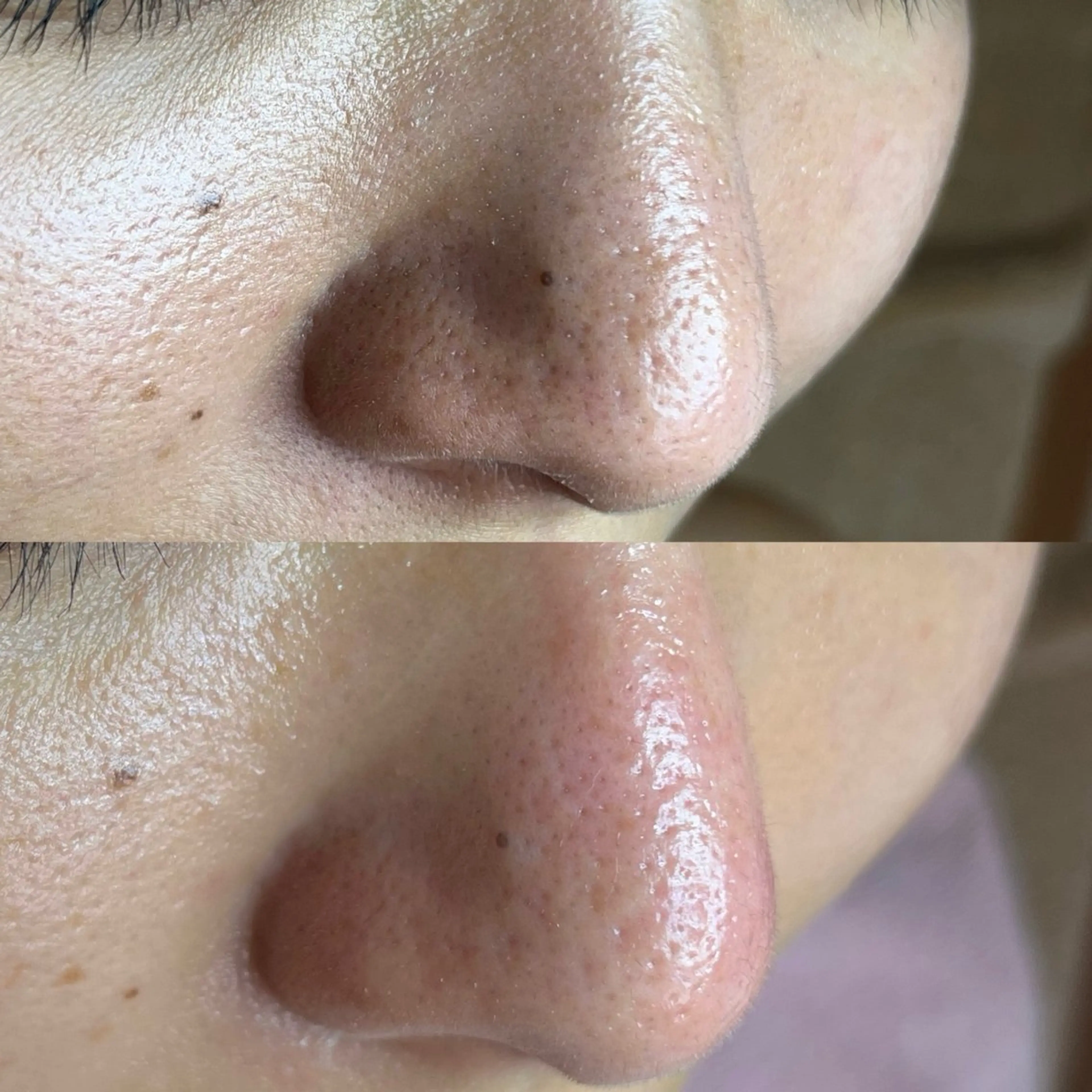 毛穴ケア・ヘッドスパサロンSHINY(シャイニー)所属・毛穴ケア・ヘッドスパ サロンSHINYのエステ・リラクイメージ