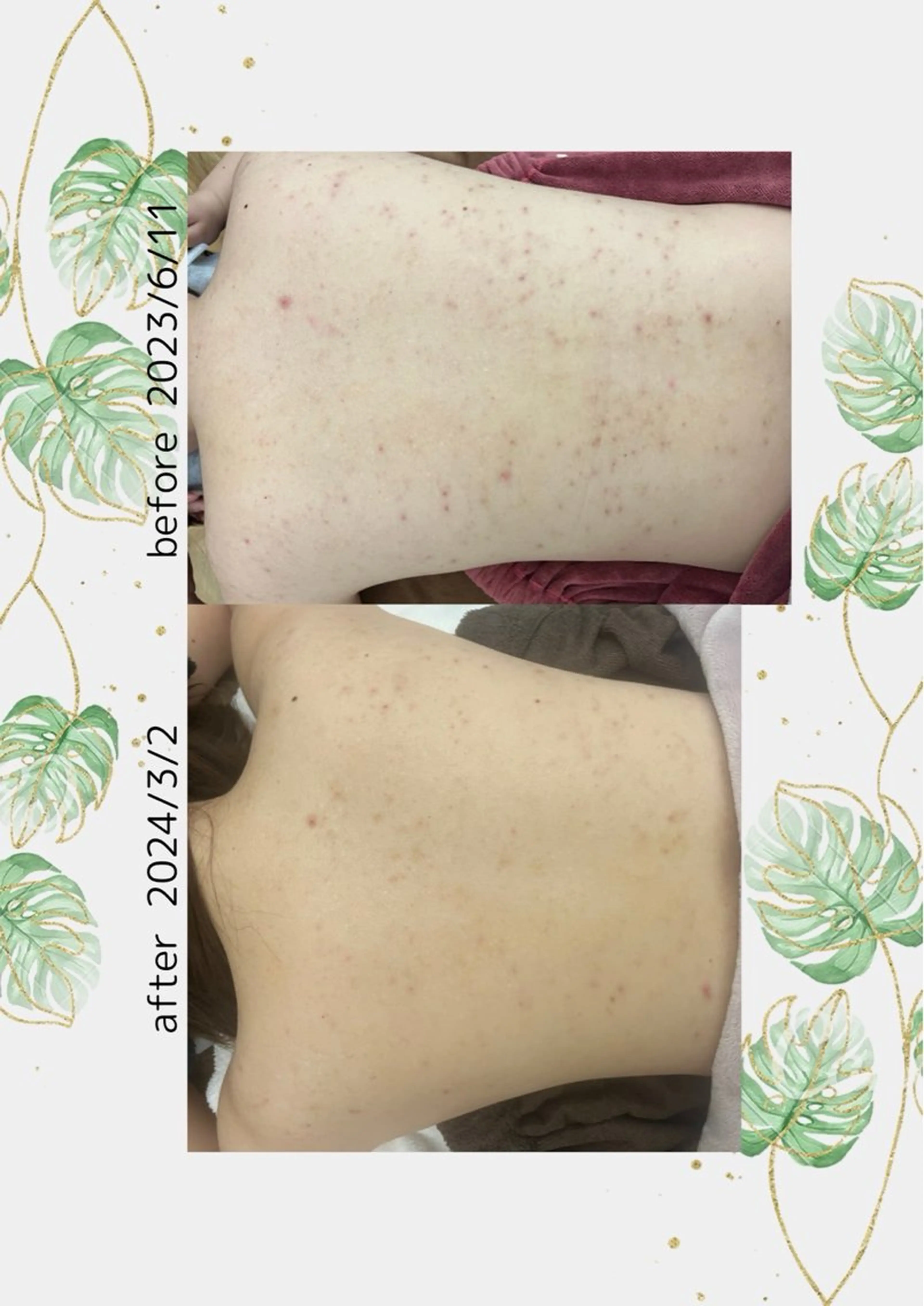 ベルーテ エッセンスのエステ・リラクイメージ