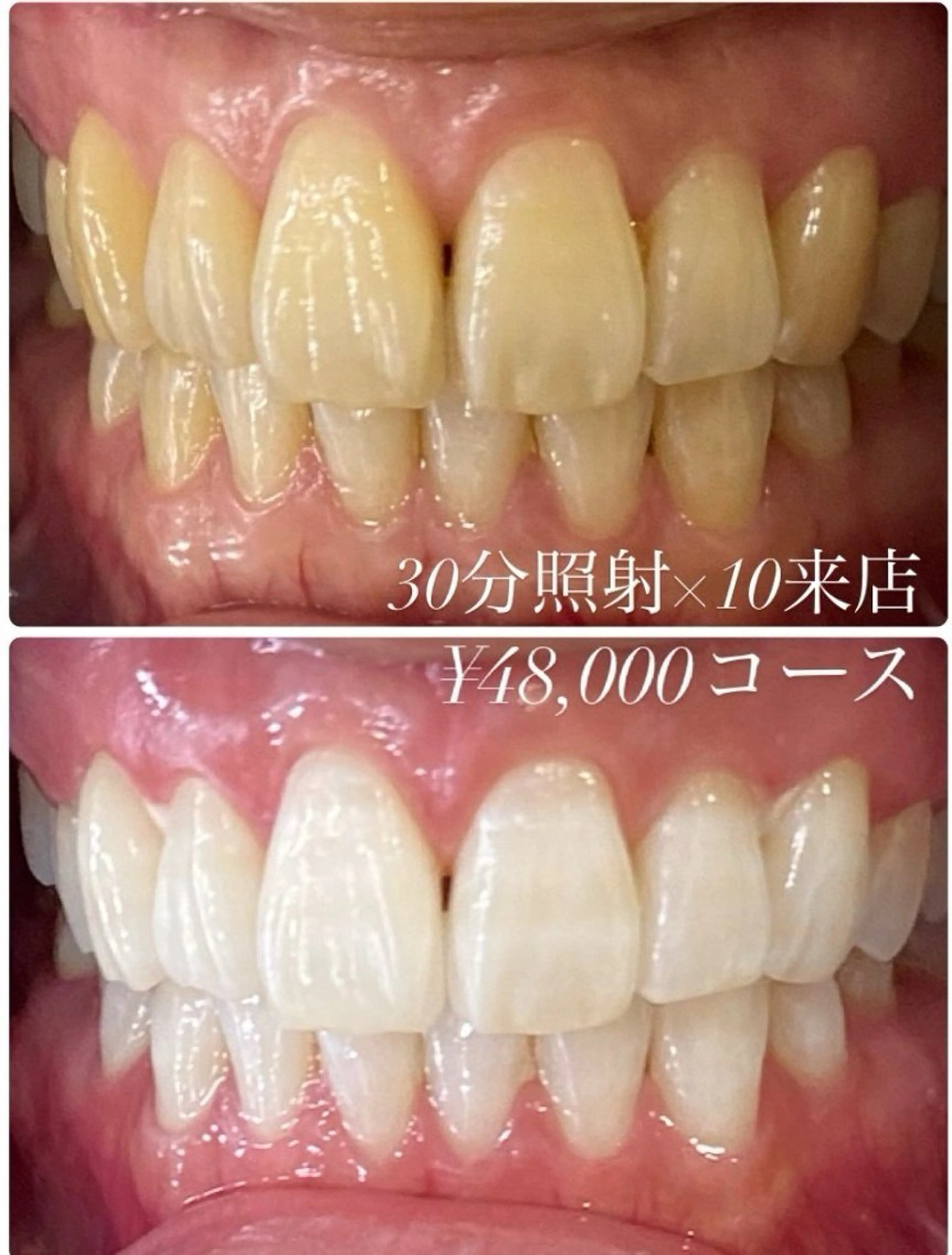 PLATINUM Beauty 横浜店所属・ホワイトニングルーム 横浜店のその他イメージ