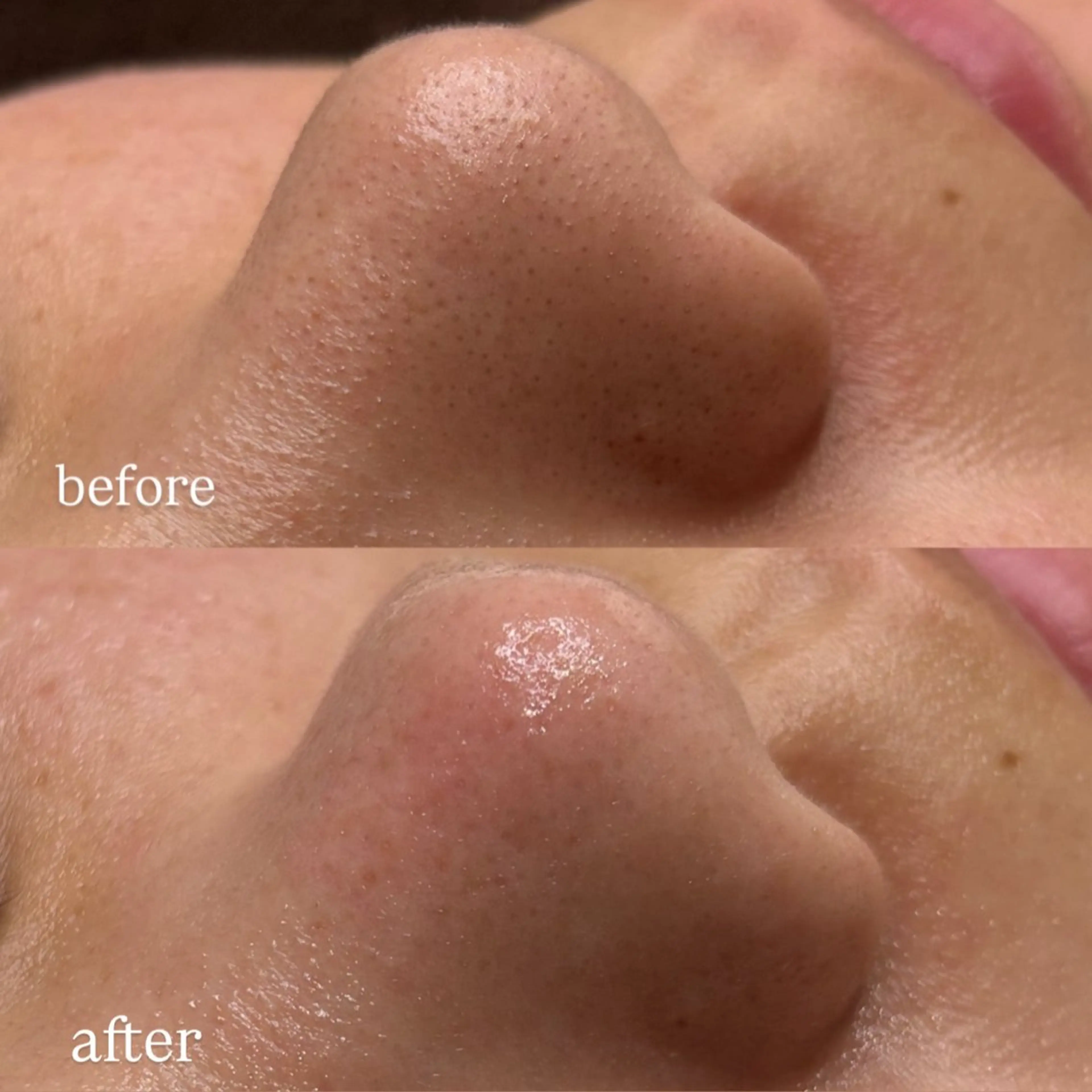 レアエイト所属・lea'8 lea'8のエステ・リラクイメージ