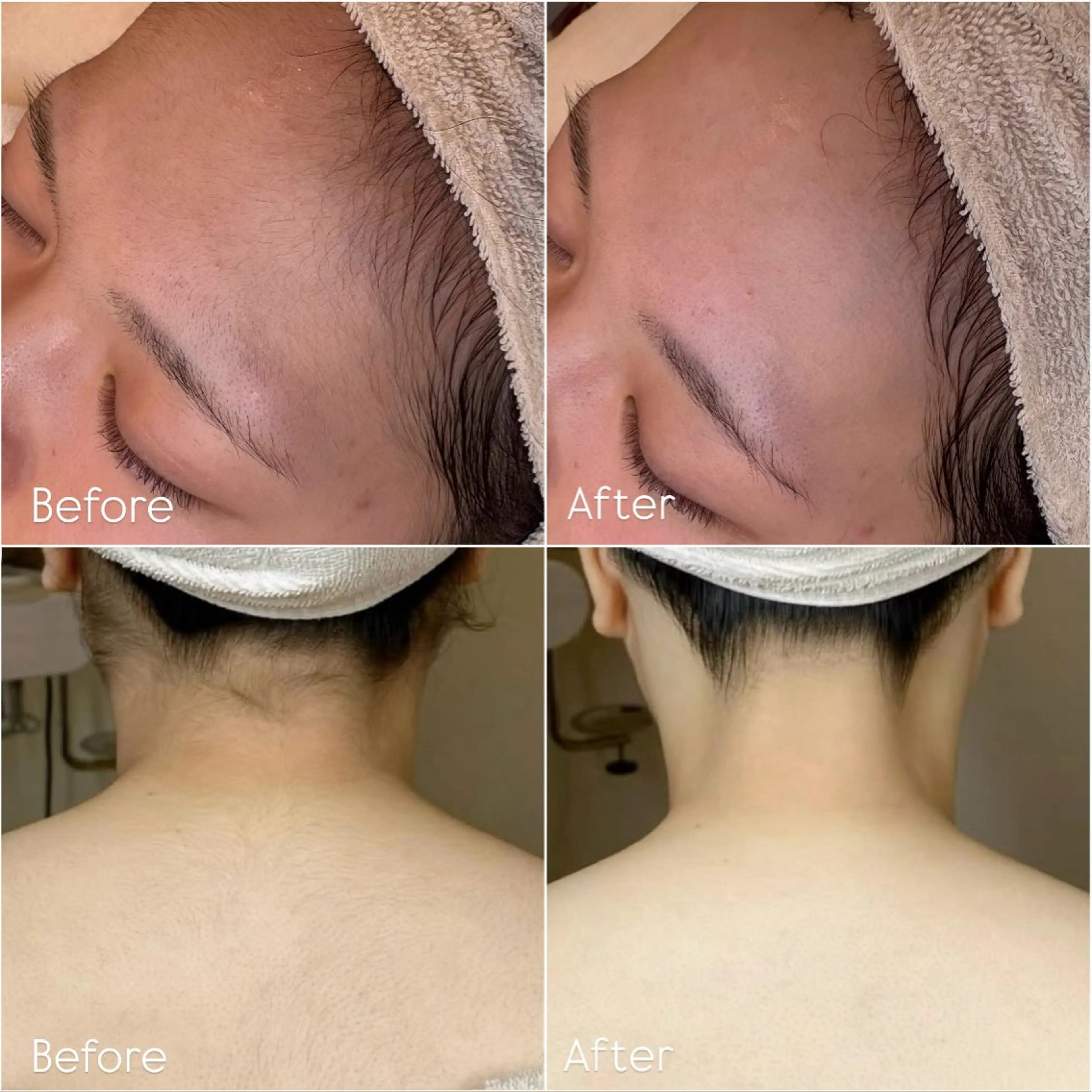 🤍フェイス&ドレスラインシェービング🤍の写真