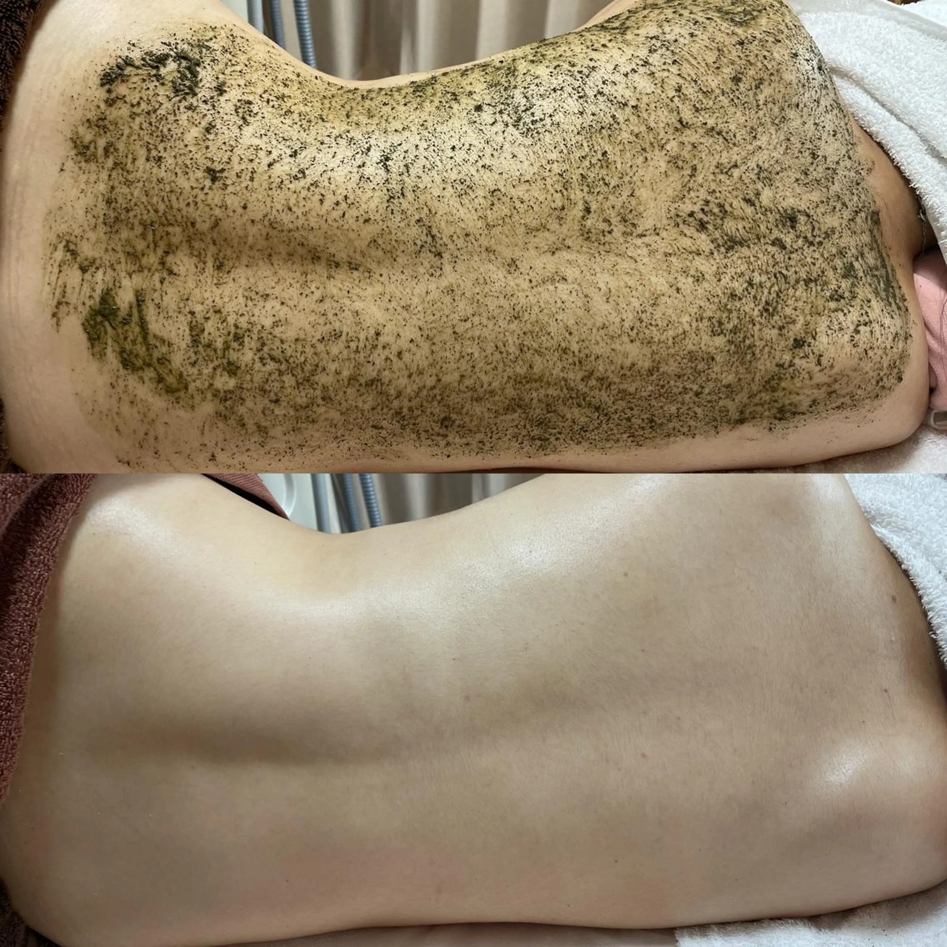 背中の為のハーブピーリング【背中上】or【背中下】【モコモコ泡パック込み】の写真