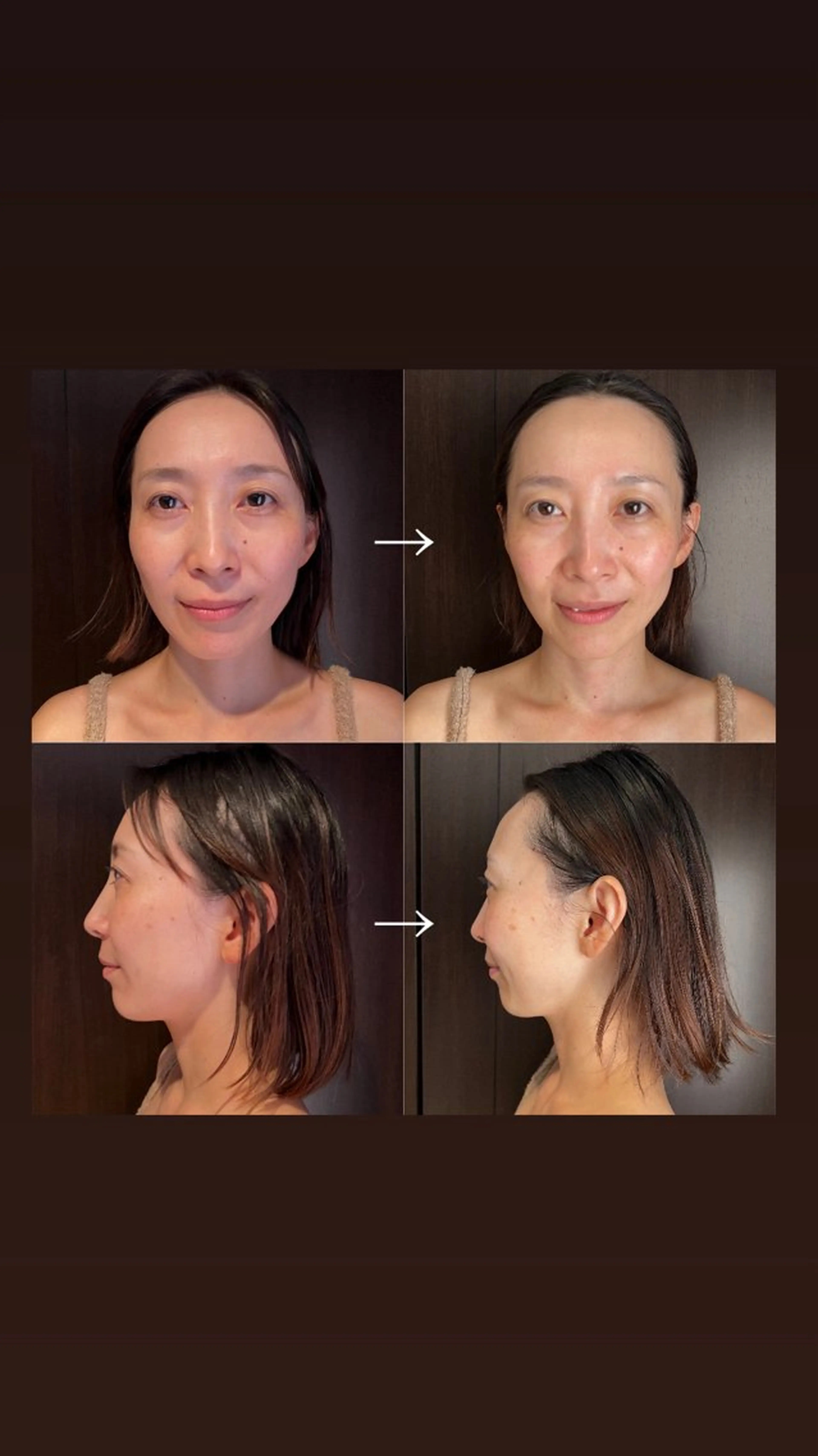 エステ WINBACK salon　un agio所属・サロンドアンアージョ un agioのエステ・リラクイメージ