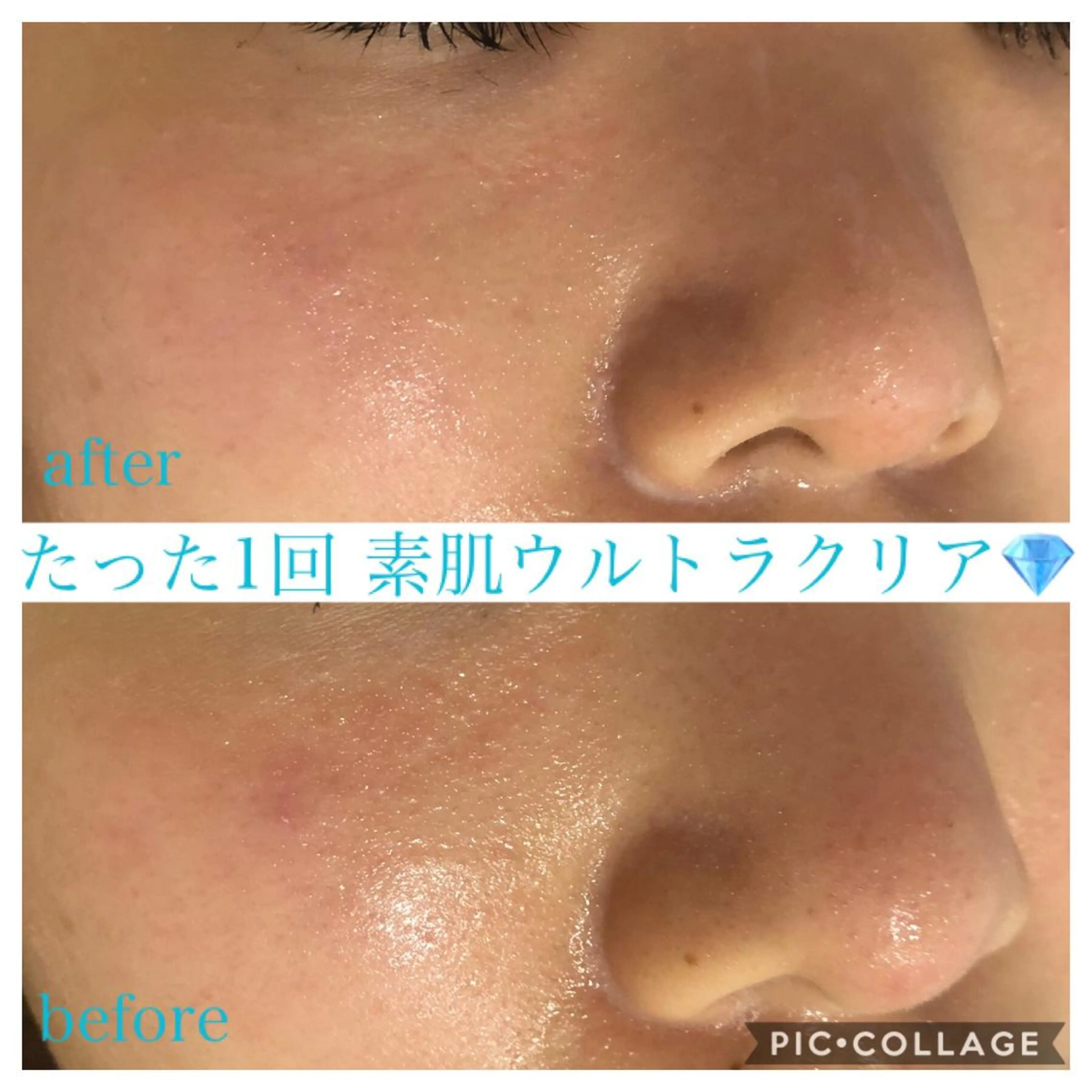 ショート カラー パーマ ヘアアレンジ キッズ ネイル マツエク・マツパ エステ リラク Ensor Clair所属・EnsorClair 代表 野口真央のエステ・リラクイメージ