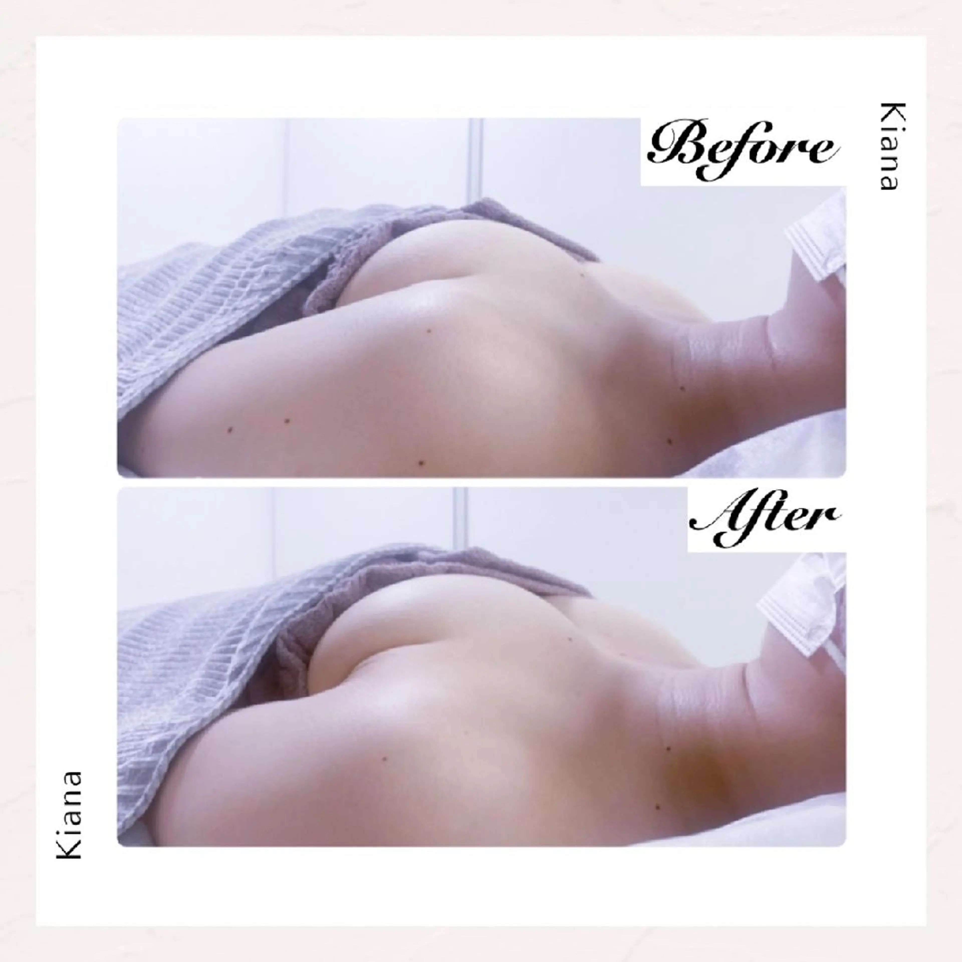 【バスト専門店 】 Kiana のエステ・リラクイメージ