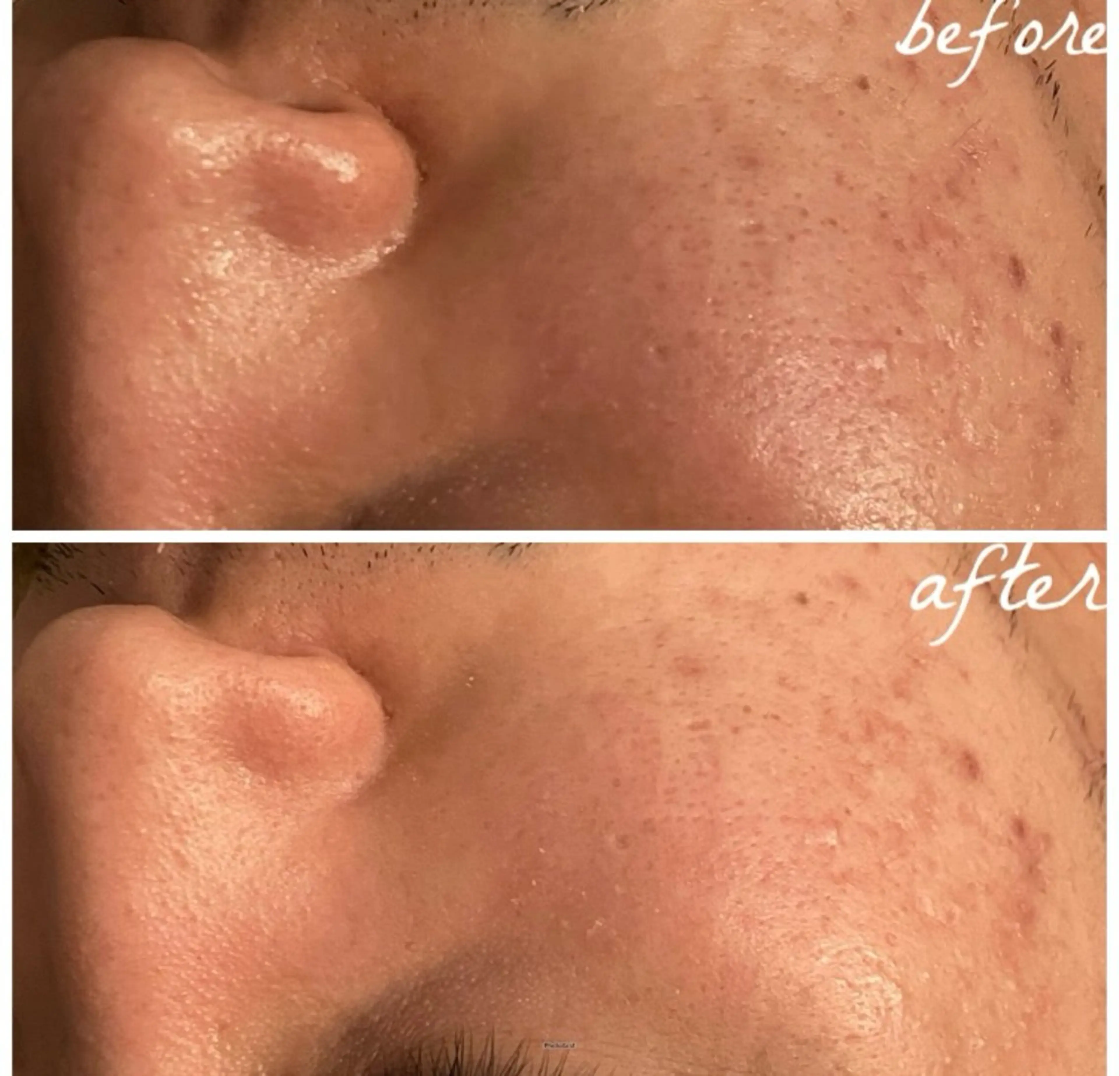 メンズ メナード岐阜茜部 杉浦のエステ・リラクイメージ