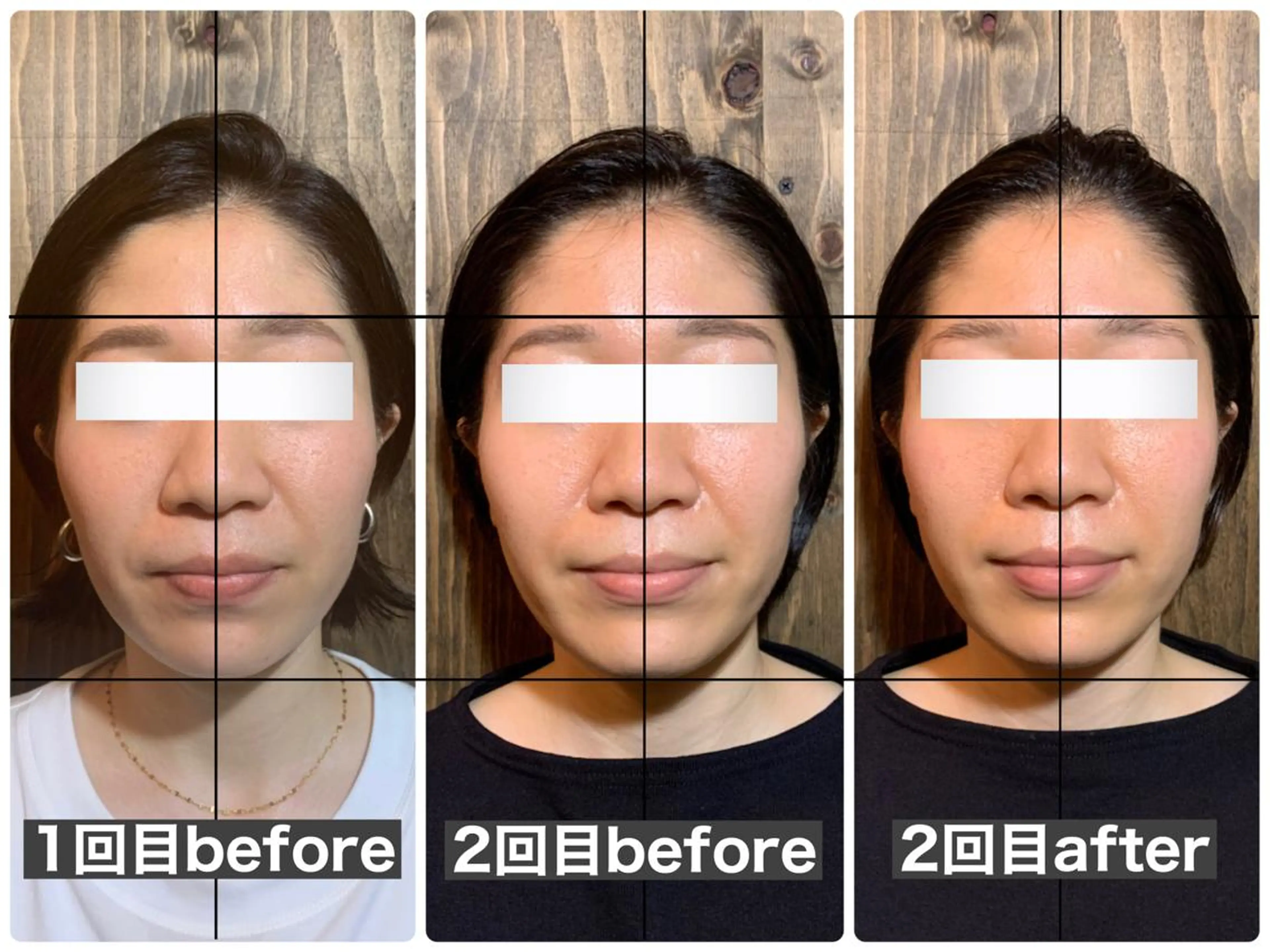 エステ リラク 💎後悔させない小顔 矯正💎イトヤマ🌱のエステ・リラクイメージ