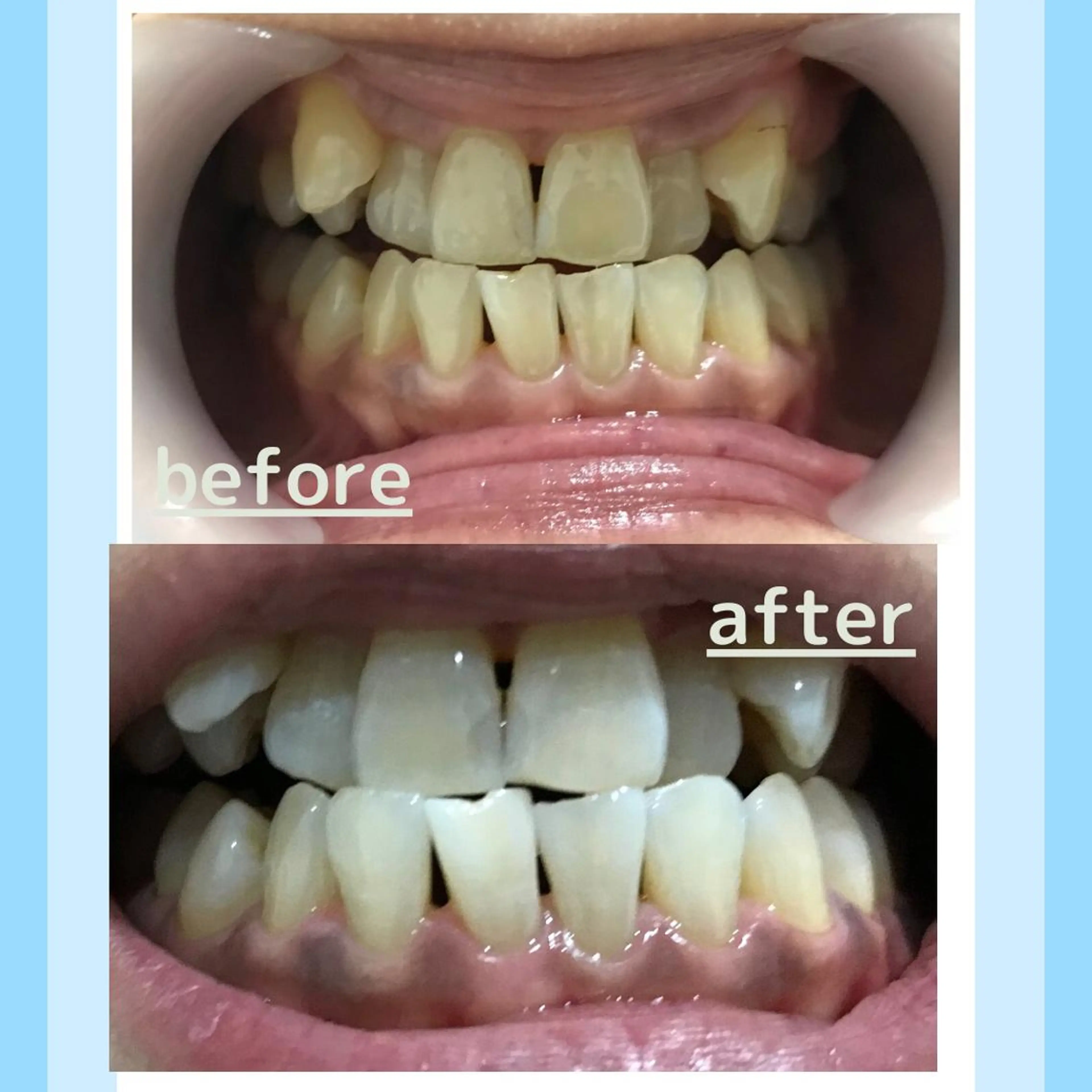 メンズ お手軽ホワイトニングsalon mina所属・武元 奈津美のその他イメージ