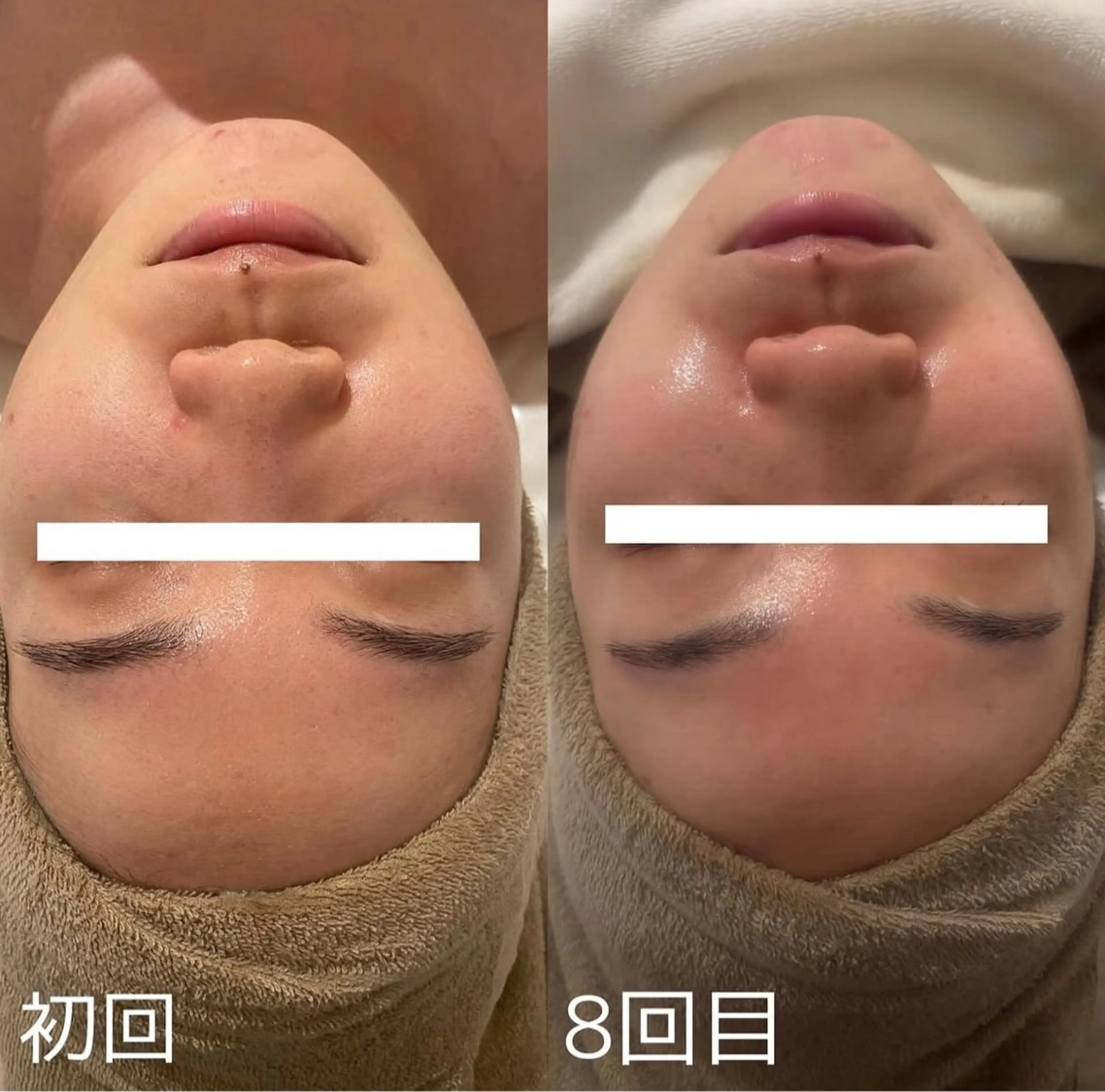 中目黒ハーブピーリン グ🌿ララピールのエステ・リラクイメージ