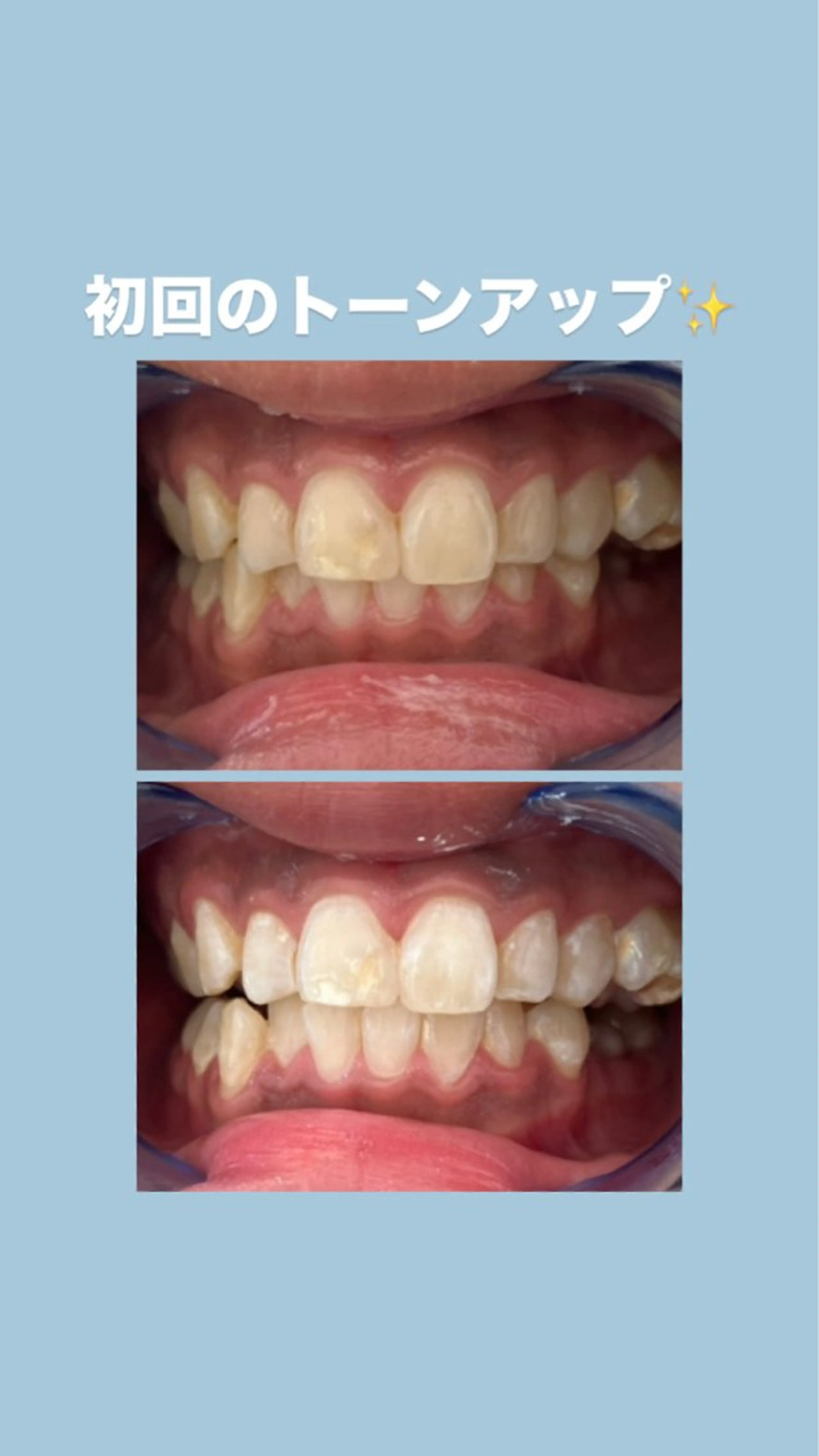 セルフホワイトニングサロンエクシアホワイト倉敷店所属・ecxiawhite 倉敷店のエステ・リラクイメージ