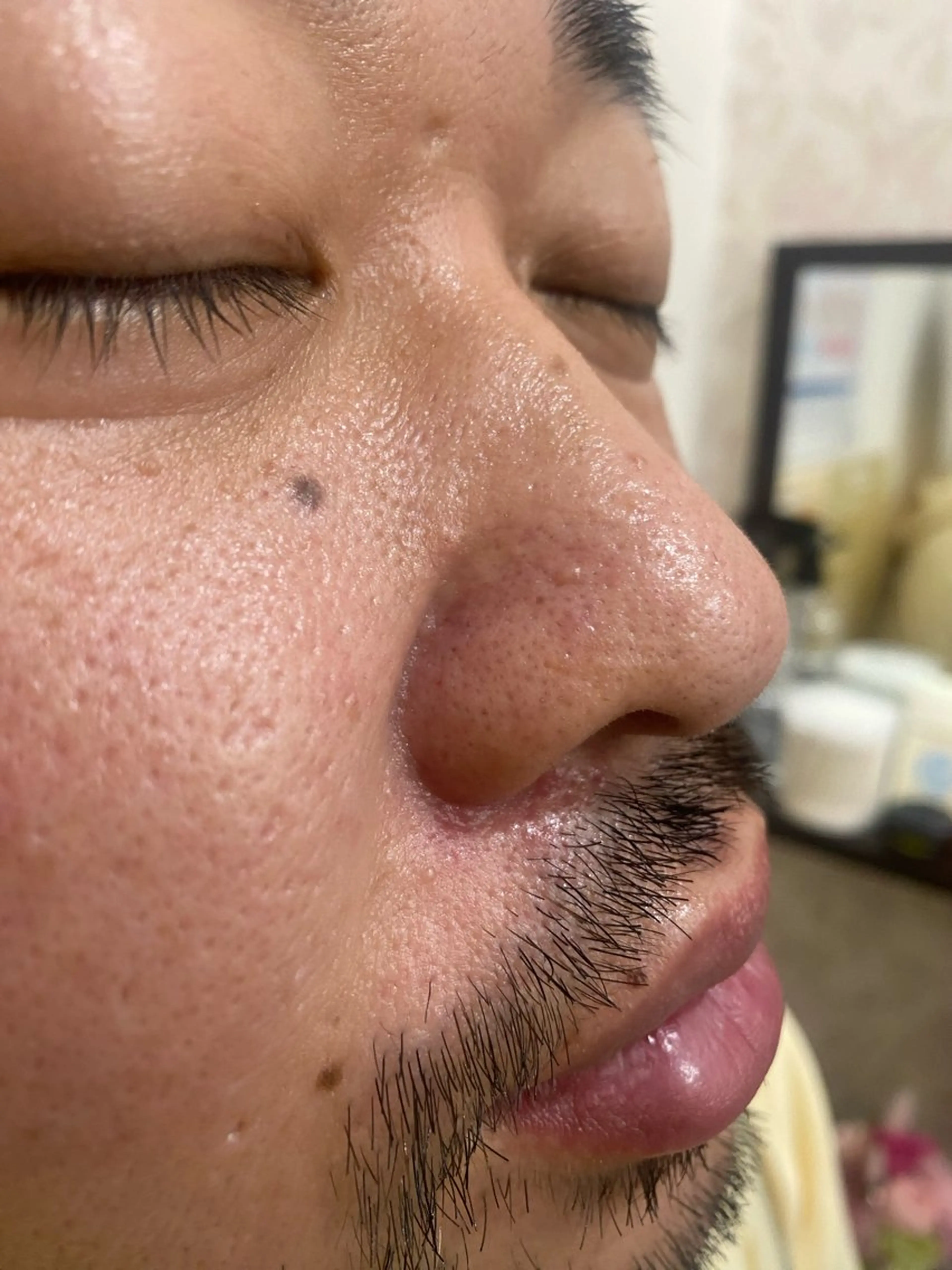 メンズ エステ Mr.Alice所属・脱毛・毛穴洗浄 【Mr.Alice】のエステ・リラクイメージ