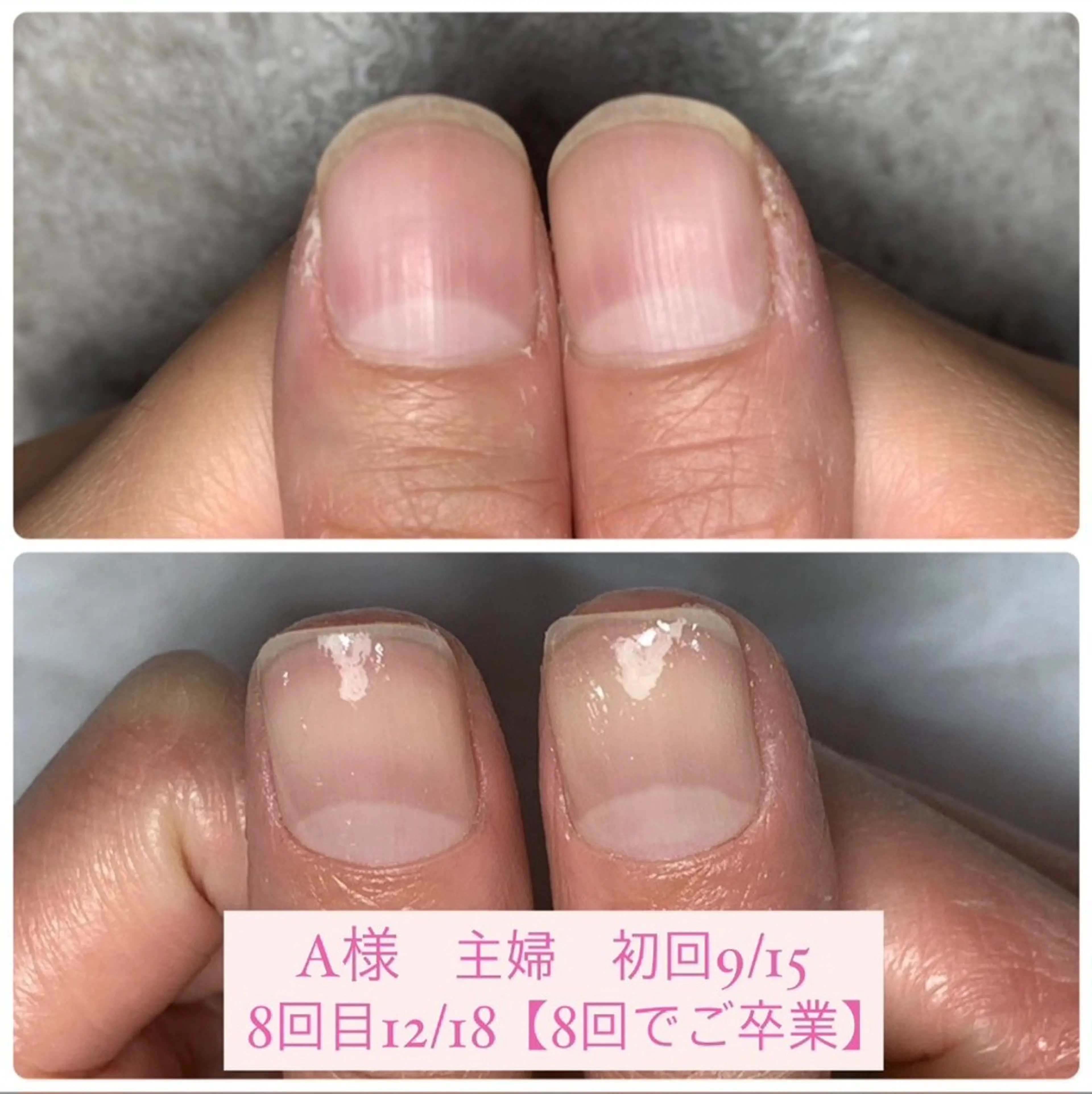 ネイル ジェルネイル ハンドケア AKT Beauty所属・AKT Beauty ドライヘッドスパのエステ・リラクイメージ