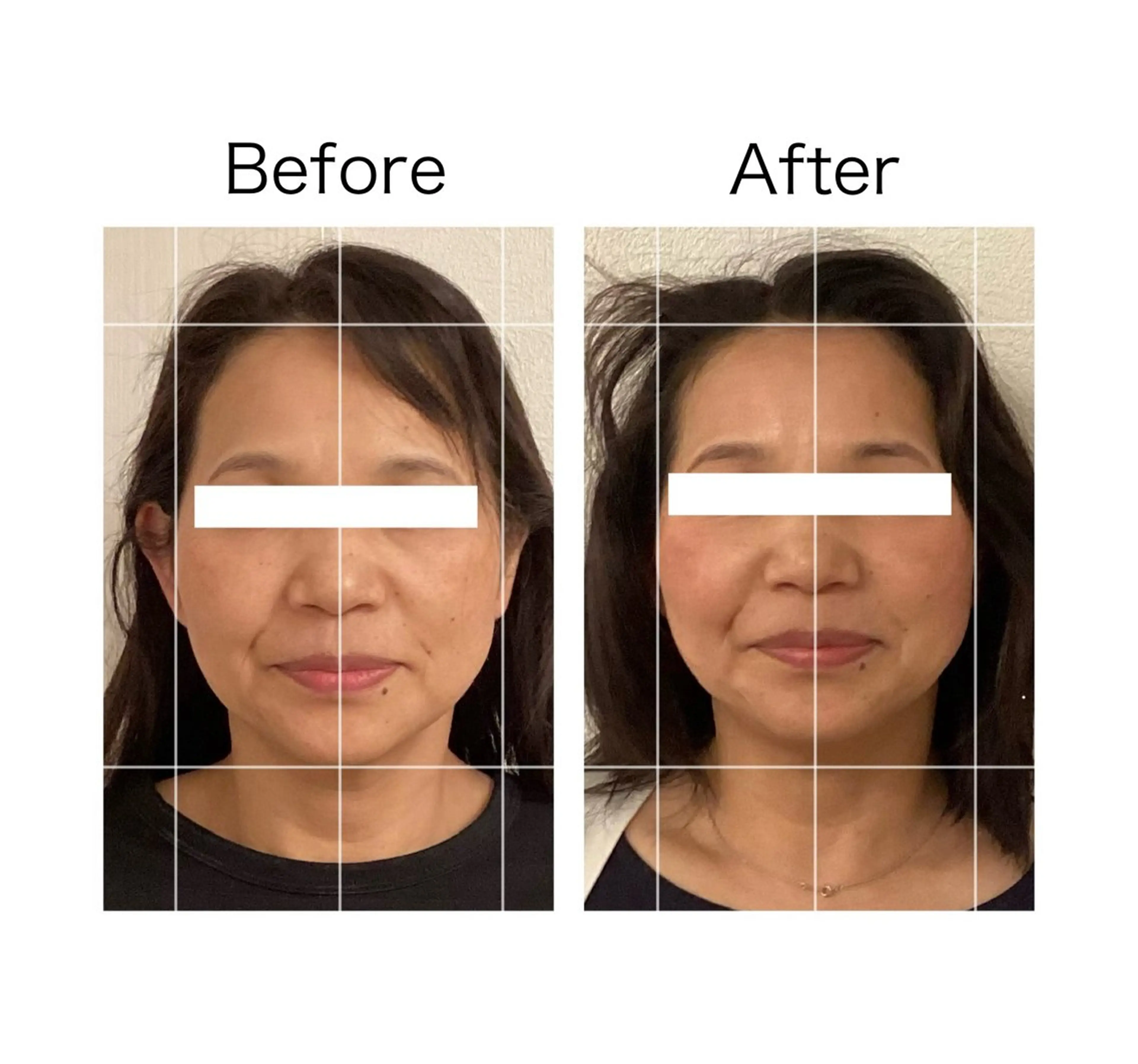 小顔サロンSharp …腸調整よもぎ蒸しのエステ・リラクイメージ