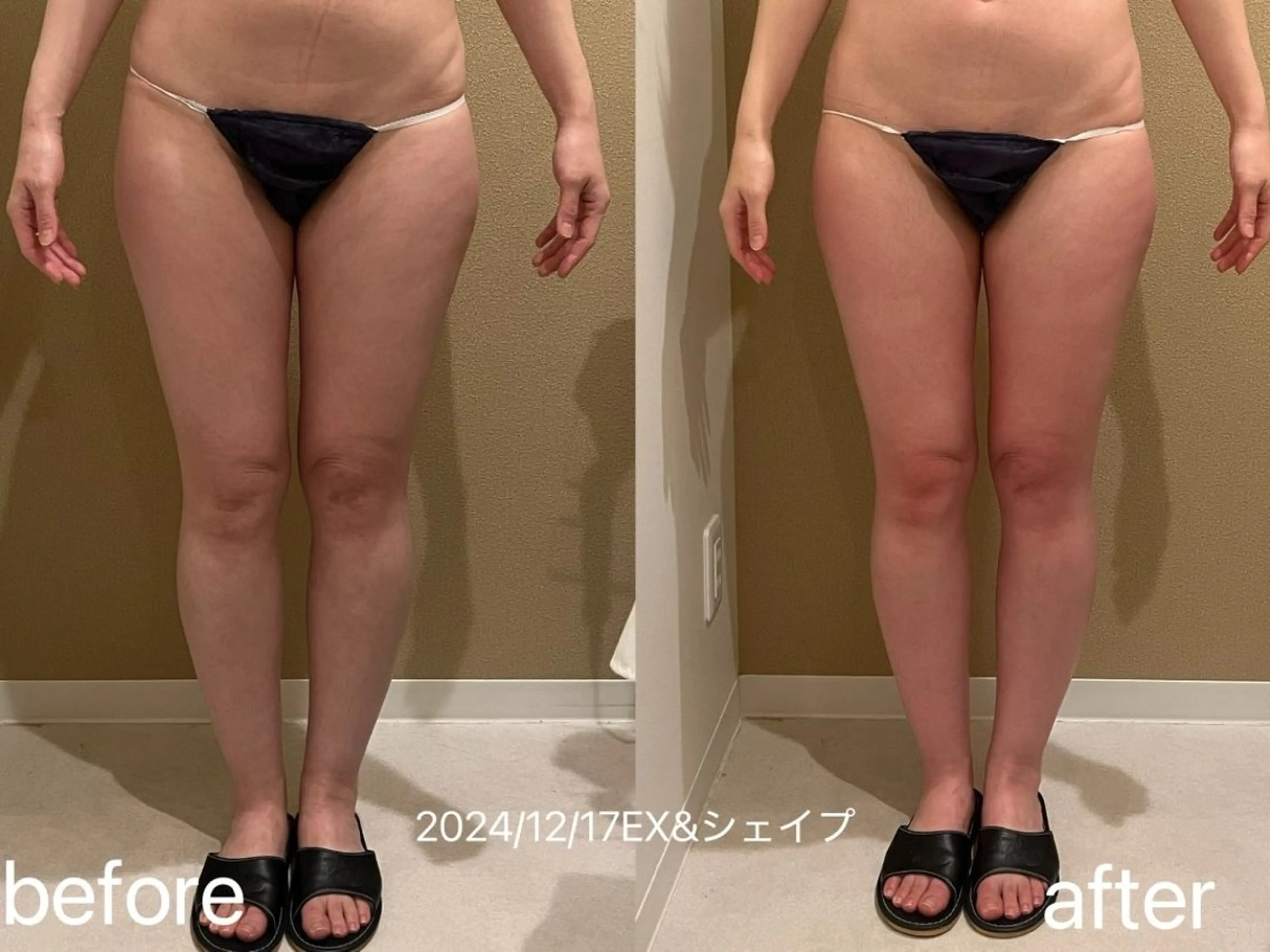 エステ リラク 小顔＆まつ毛サロン AKANE❤️のエステ・リラクイメージ