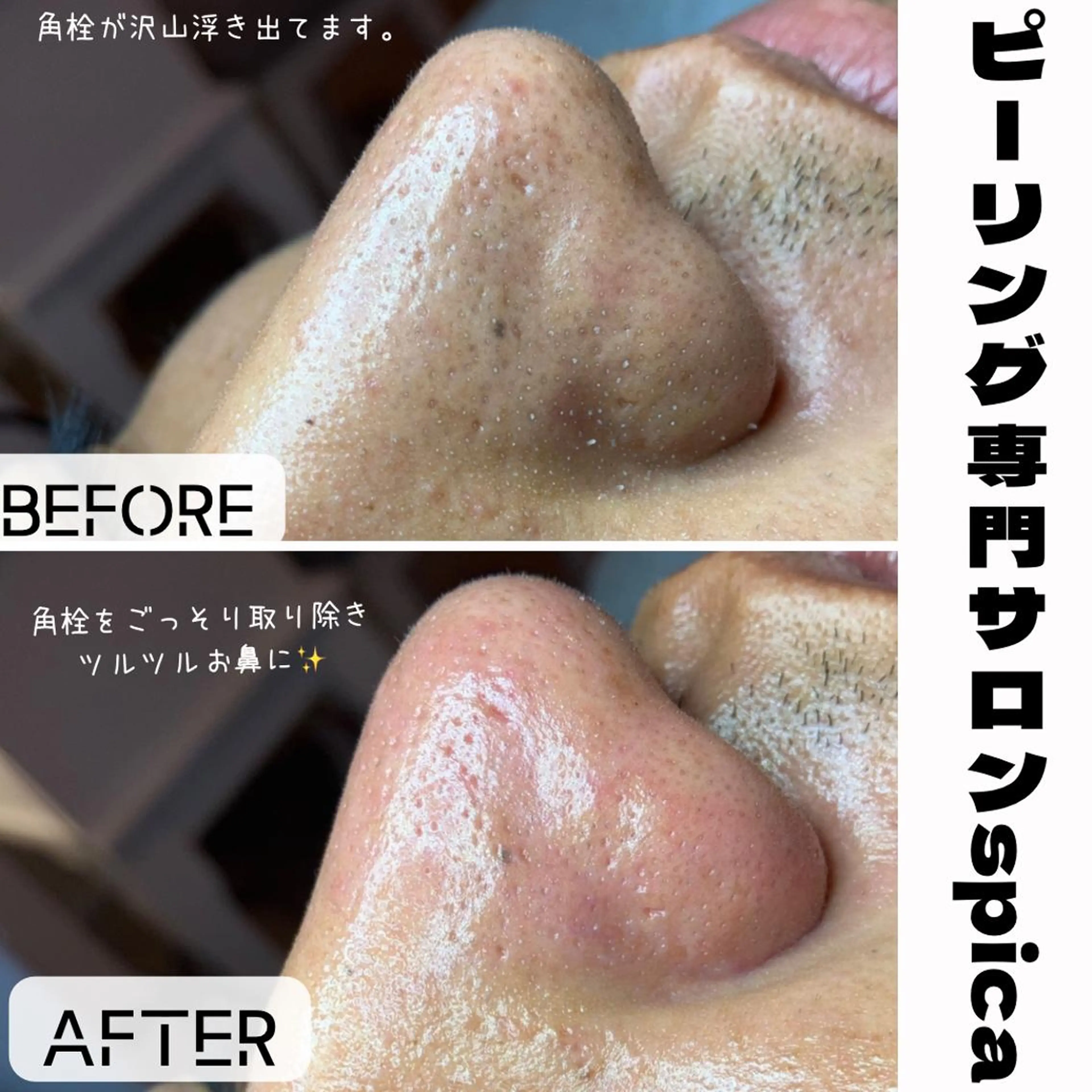 ピーリング専門サロン Spicaのエステ・リラクイメージ