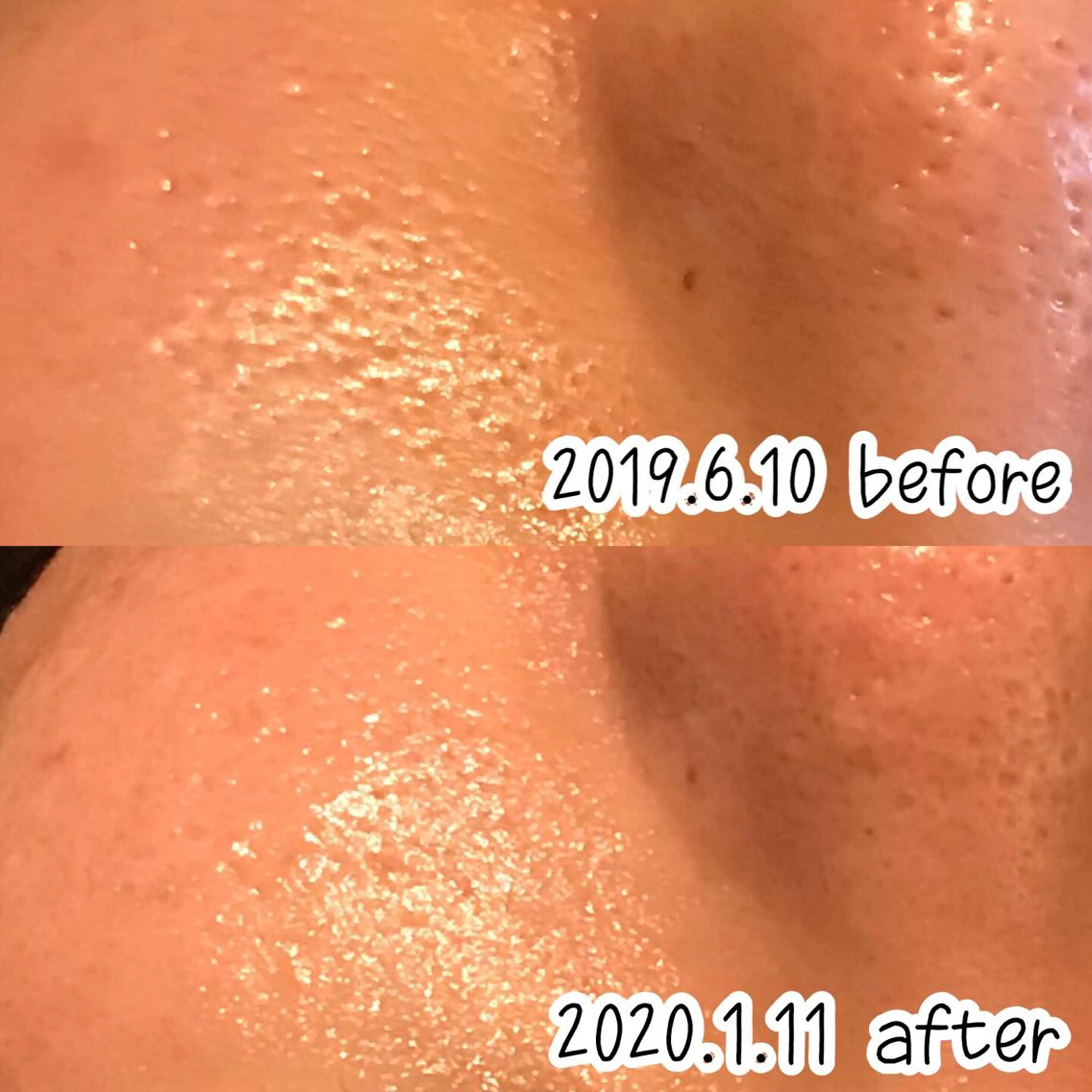 エステ 浜野 恵美のエステ・リラクイメージ