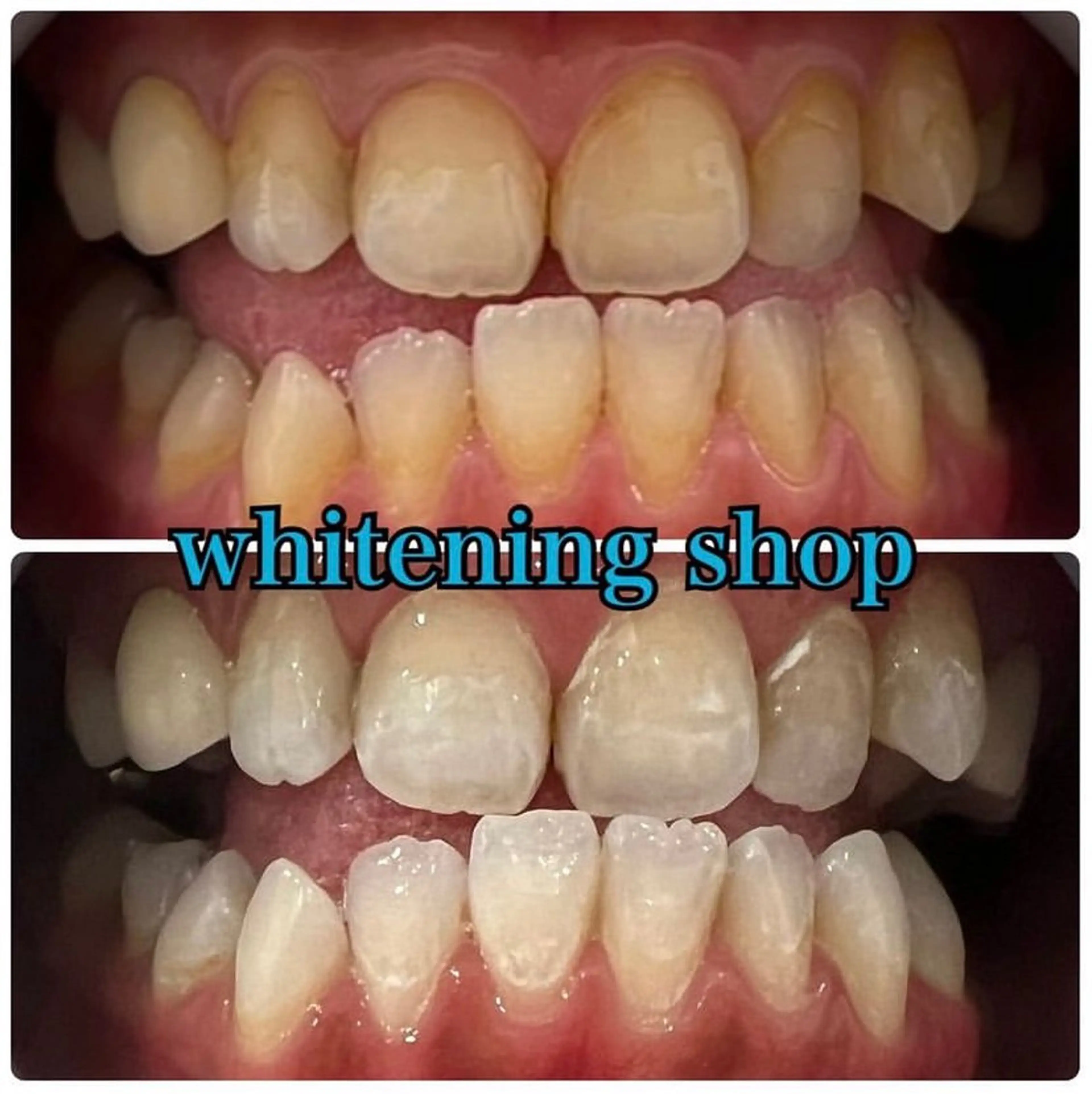 エステ リラク ホワイトニング ショップ吉祥寺店のエステ・リラクイメージ