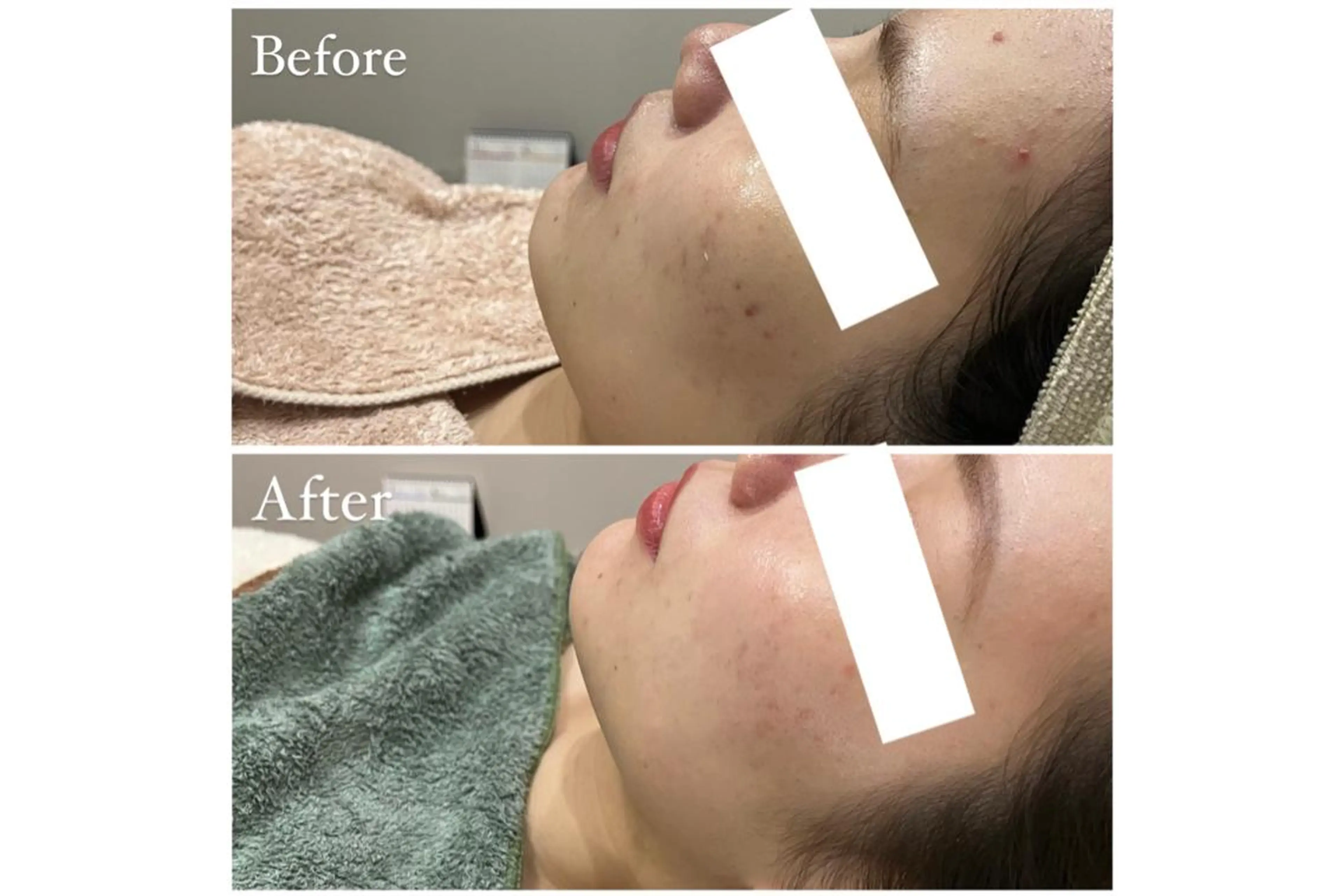 ハーブピーリング専門 muro.のエステ・リラクイメージ