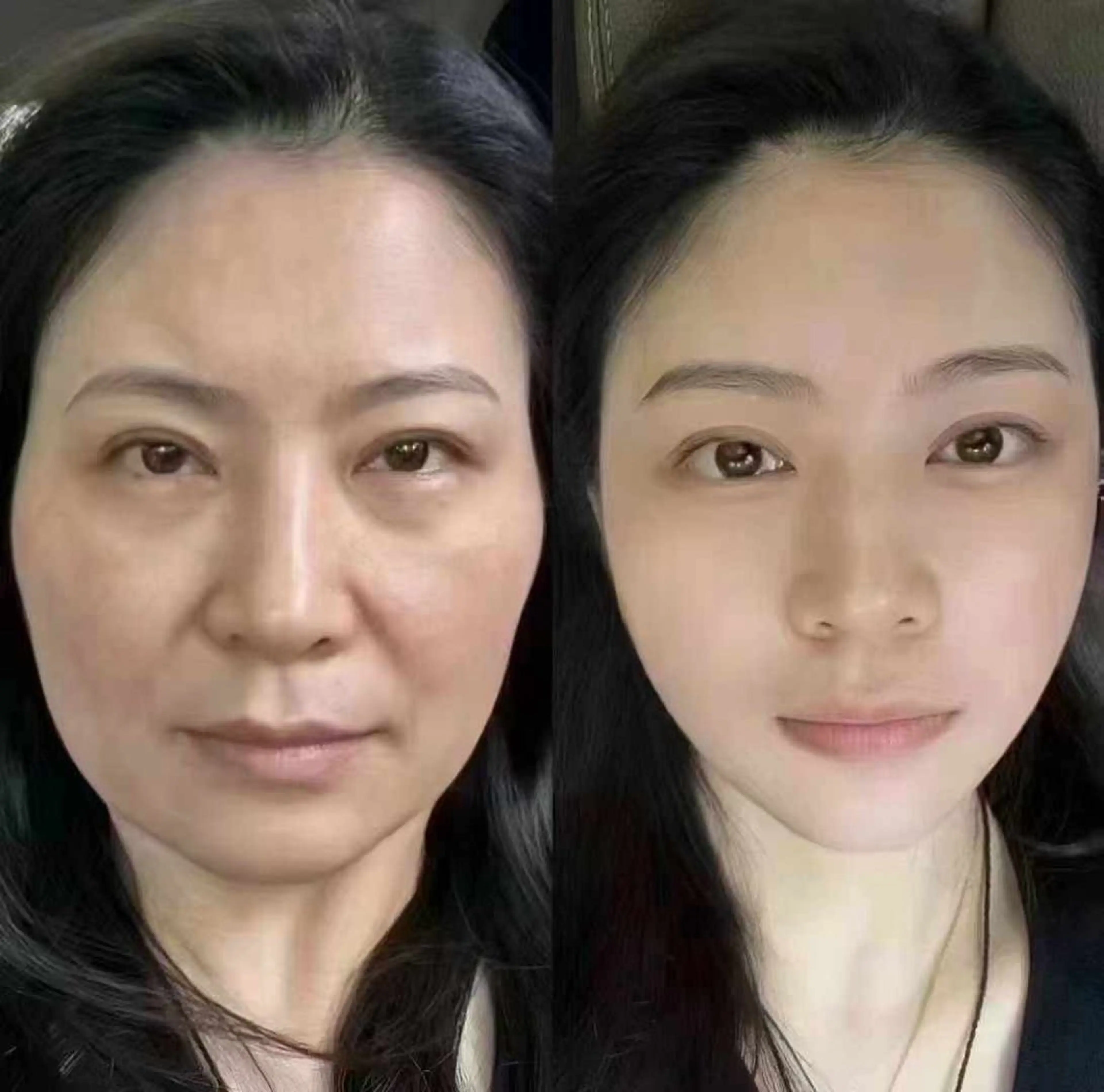 マツエク・マツパ エステ aliaハイフ&水光ジェットサロン所属・aliaハーブ水光店 エステティシャン募集のエステ・リラクイメージ