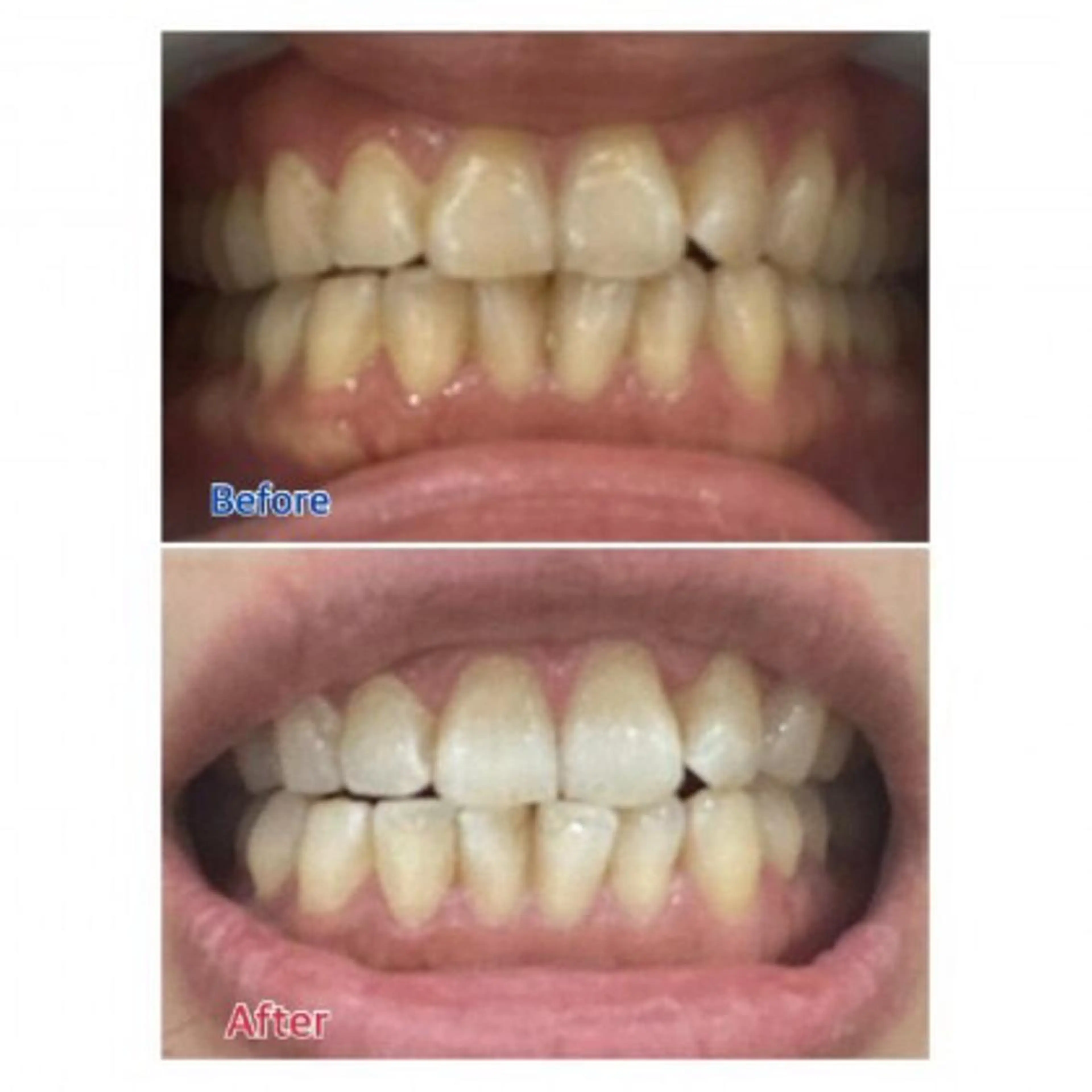 M渋谷店所属・Ｍ渋谷 ホワイトニングのエステ・リラクイメージ