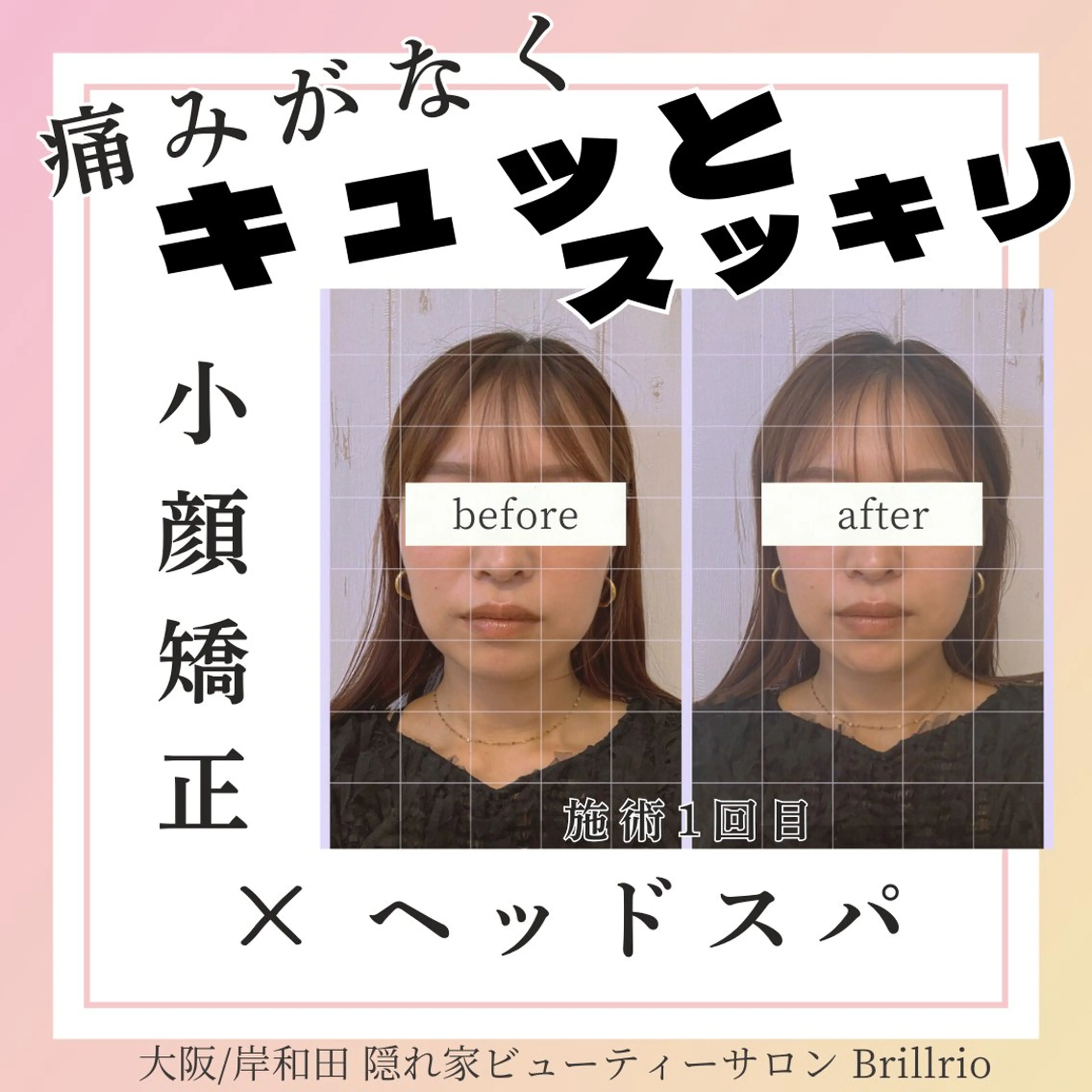 きゅっとリフットアップ小顔♪スペシャルセット【PRABHAメソッド】の写真