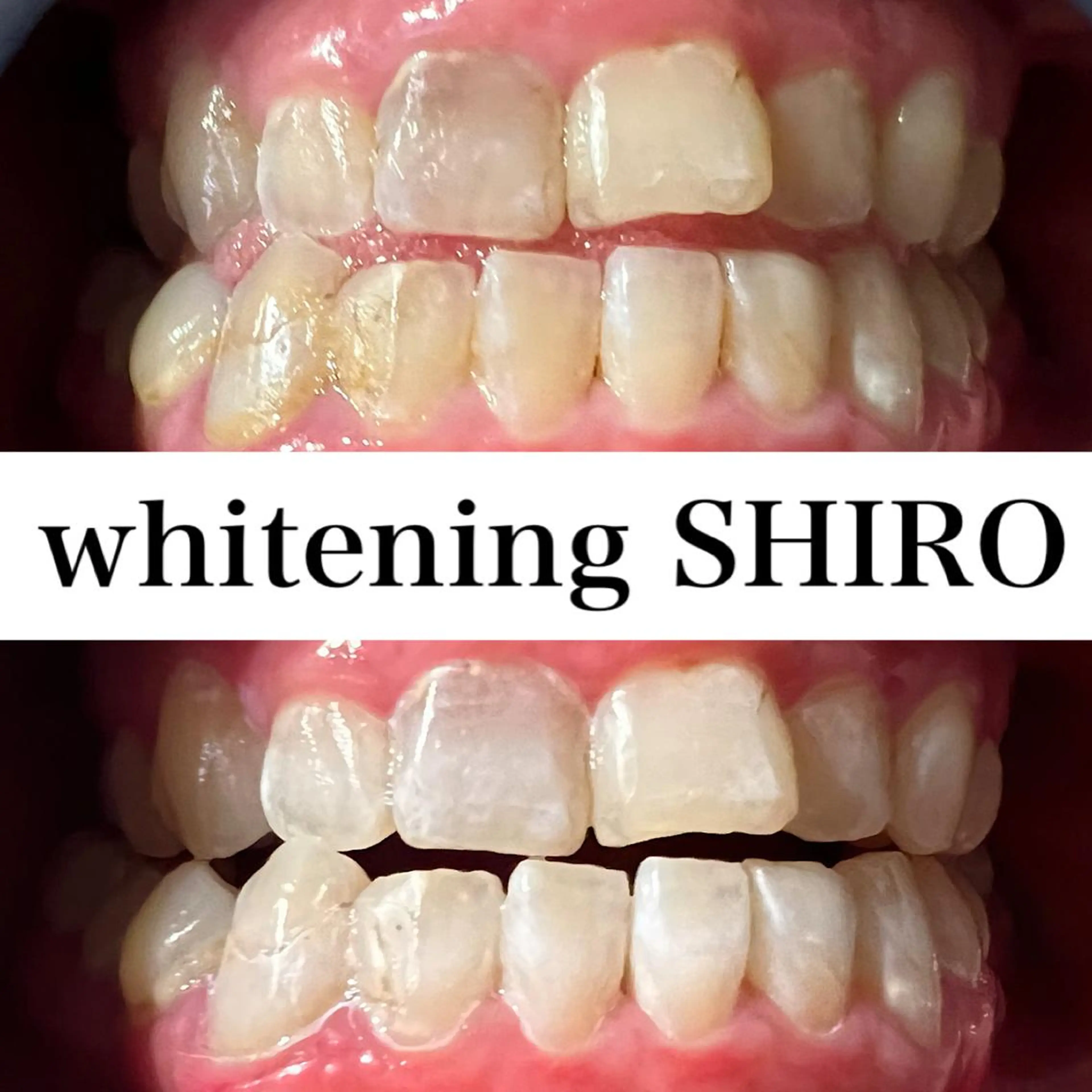 福岡ホワイトニング SHIRO天神店のエステ・リラクイメージ