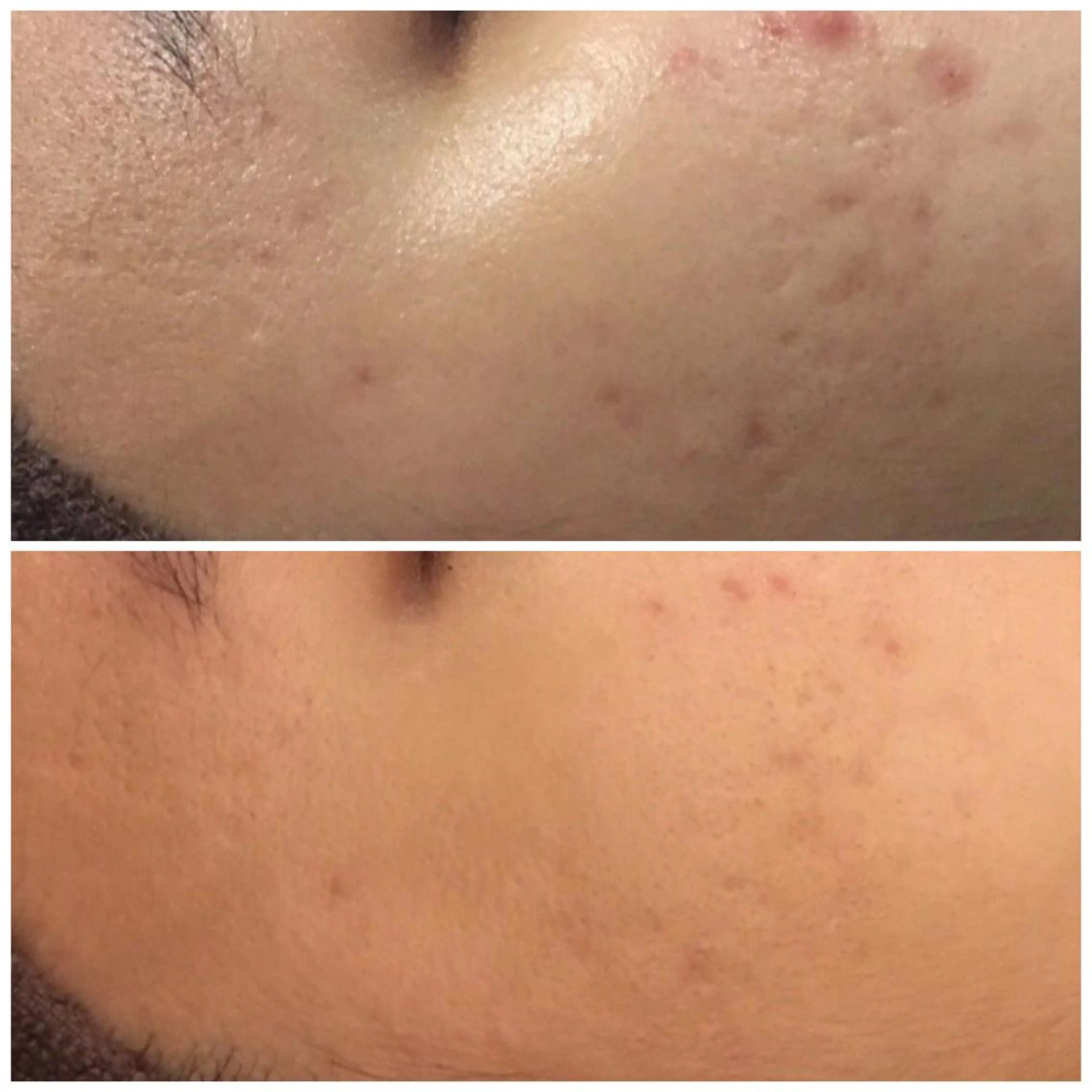 触れたくなる モテ肌へ...❤︎のエステ・リラクイメージ