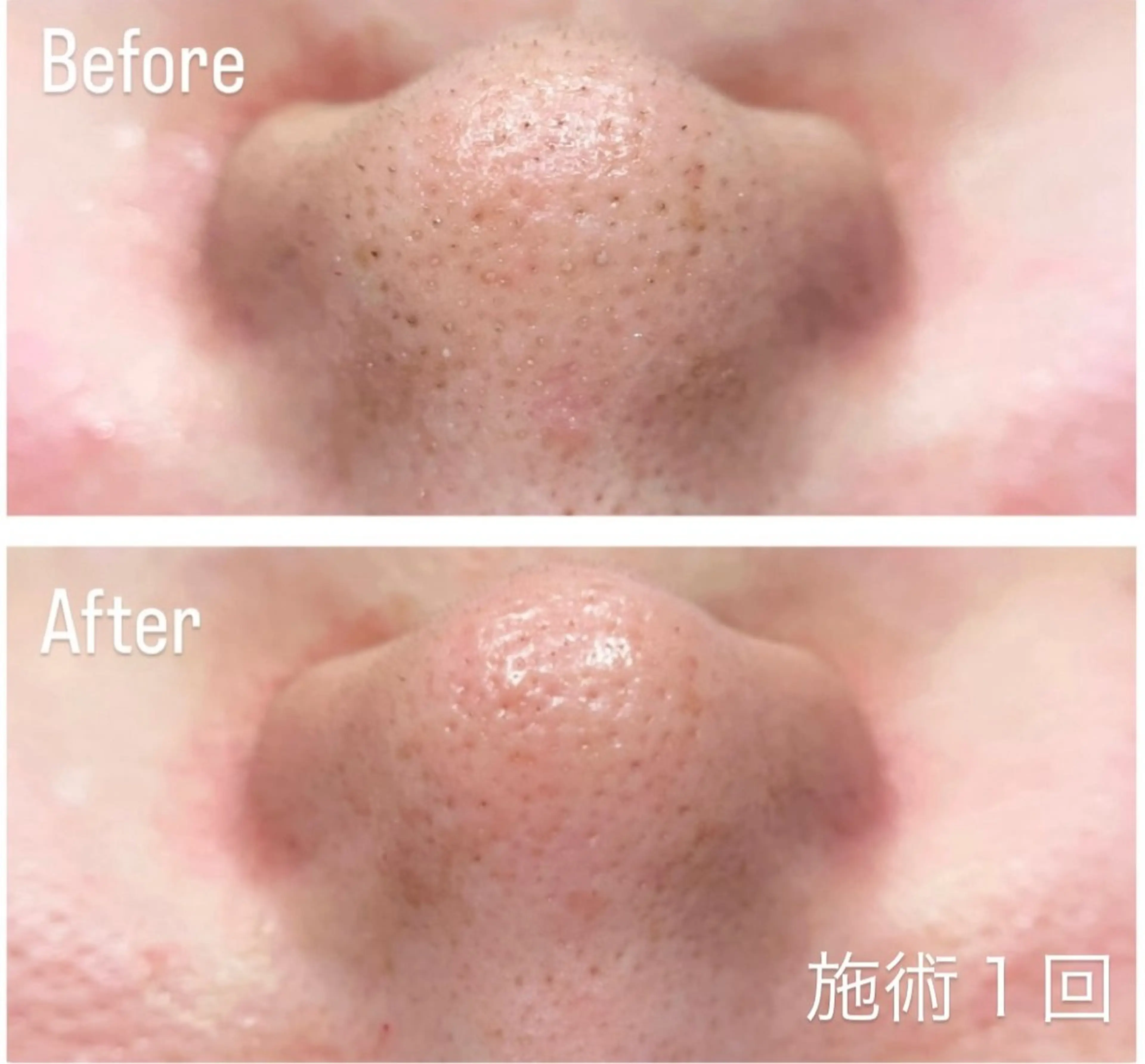 アンド ミルルのエステ・リラクイメージ