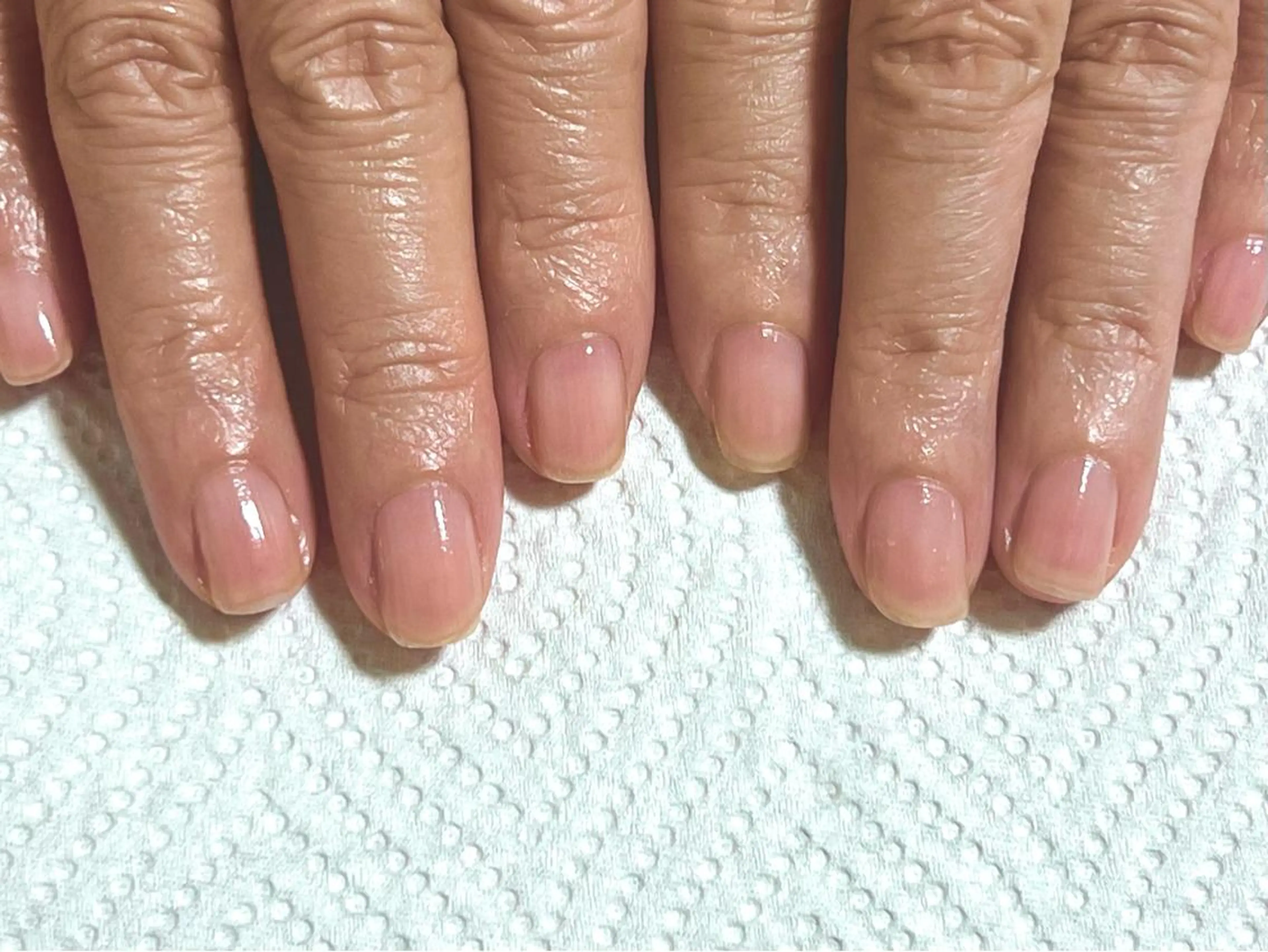 ネイル ハンドネイル ハンドケア 【爪の育成専門】深爪・むしり癖・丸い爪・ガサガサなど　　Rio nail所属・Rio nail まなみのネイルデザイン