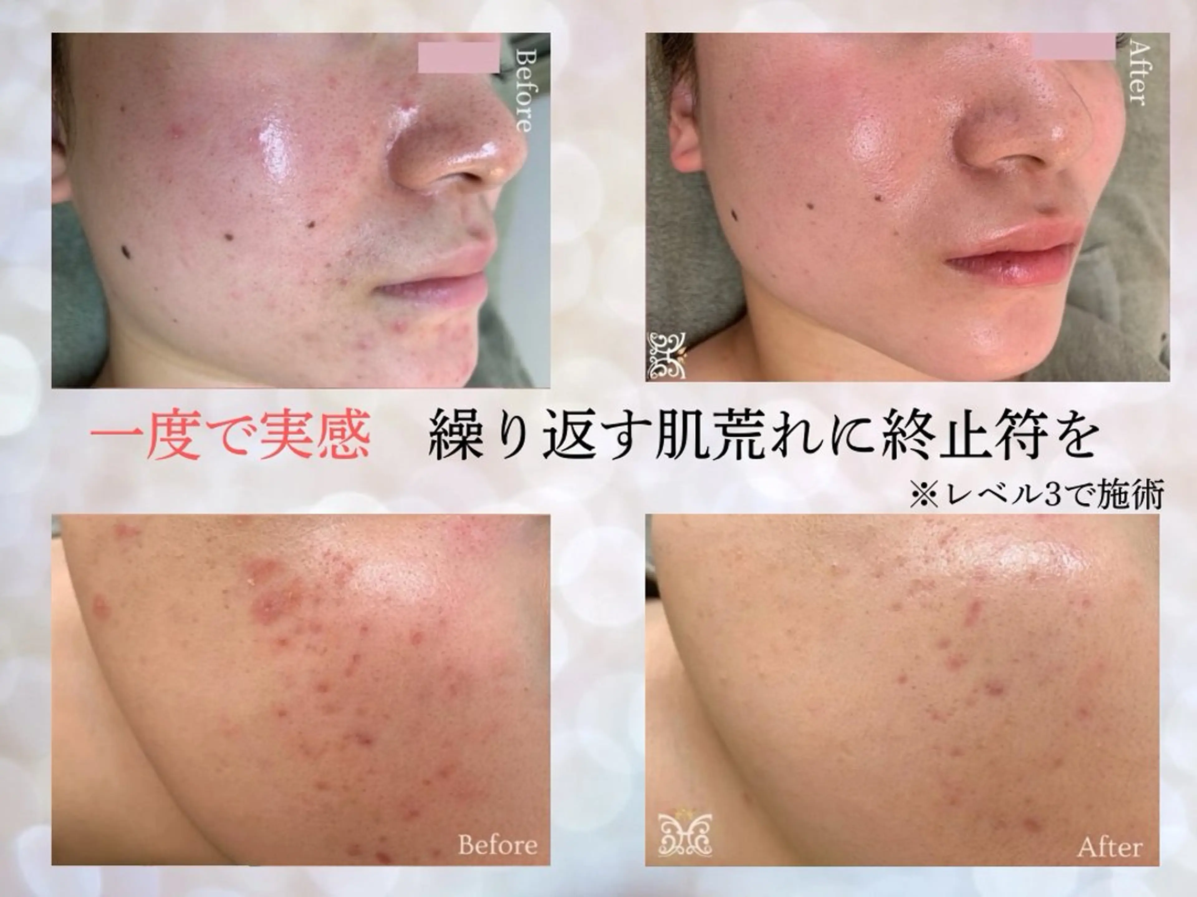 VIKI BEAUTY クレイハーブピーリング・美肌脱毛専門店所属・VIKI BEAUTYのエステ・リラクイメージ