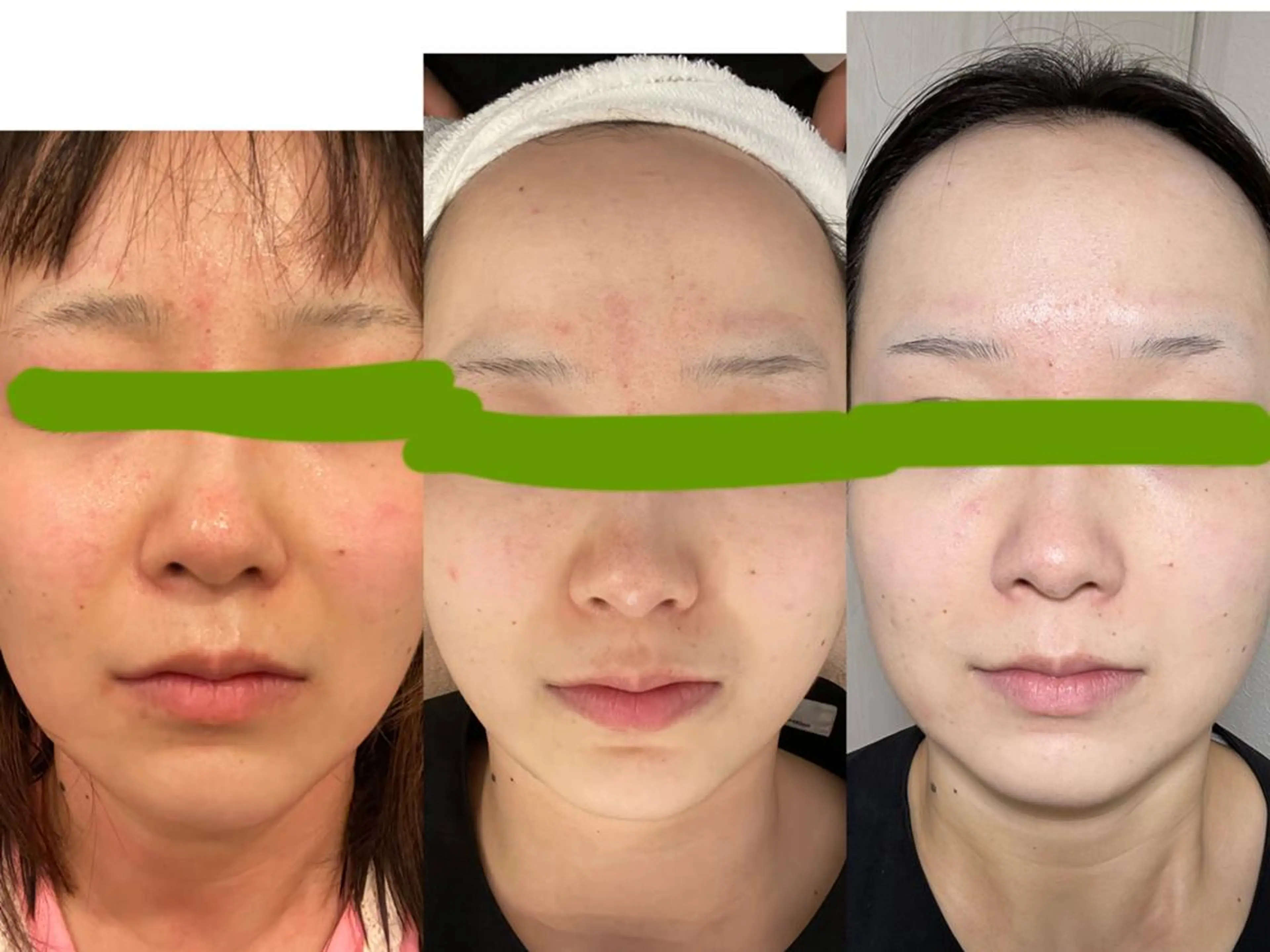 その他 OPREA 千種店のエステ・リラクイメージ