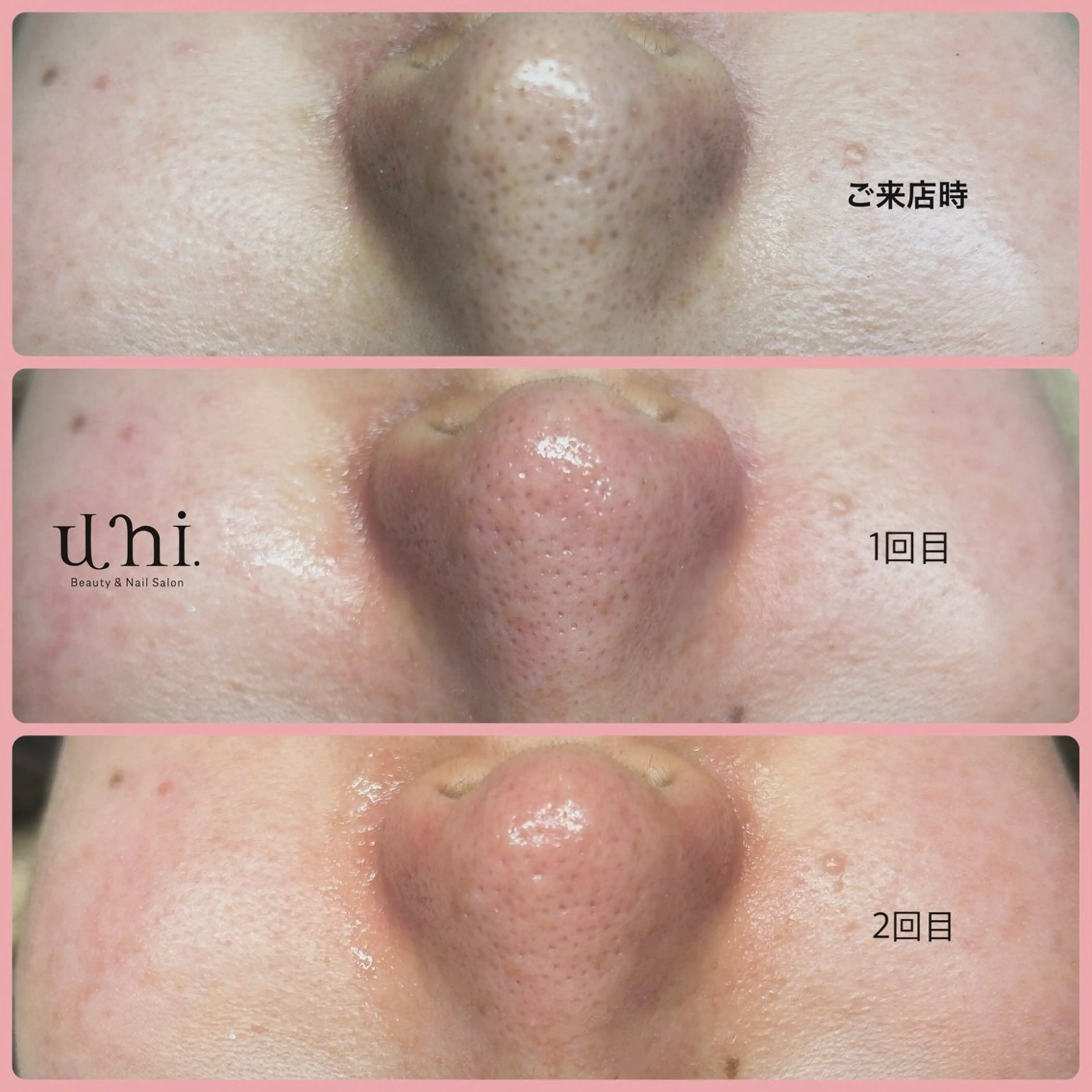 uni. beautyのエステ・リラクイメージ