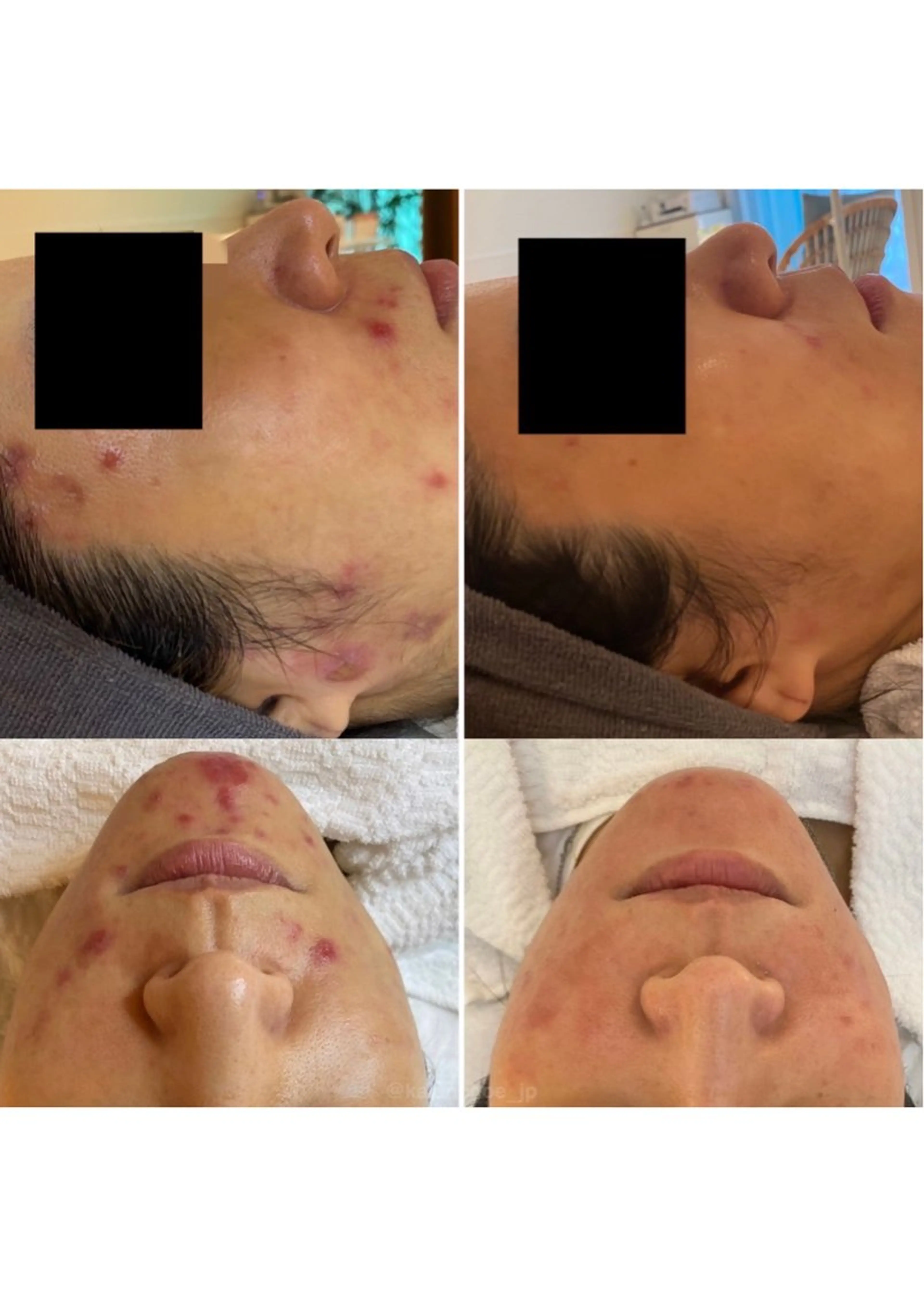 エステ 肌質改善 KALANCHOEのエステ・リラクイメージ