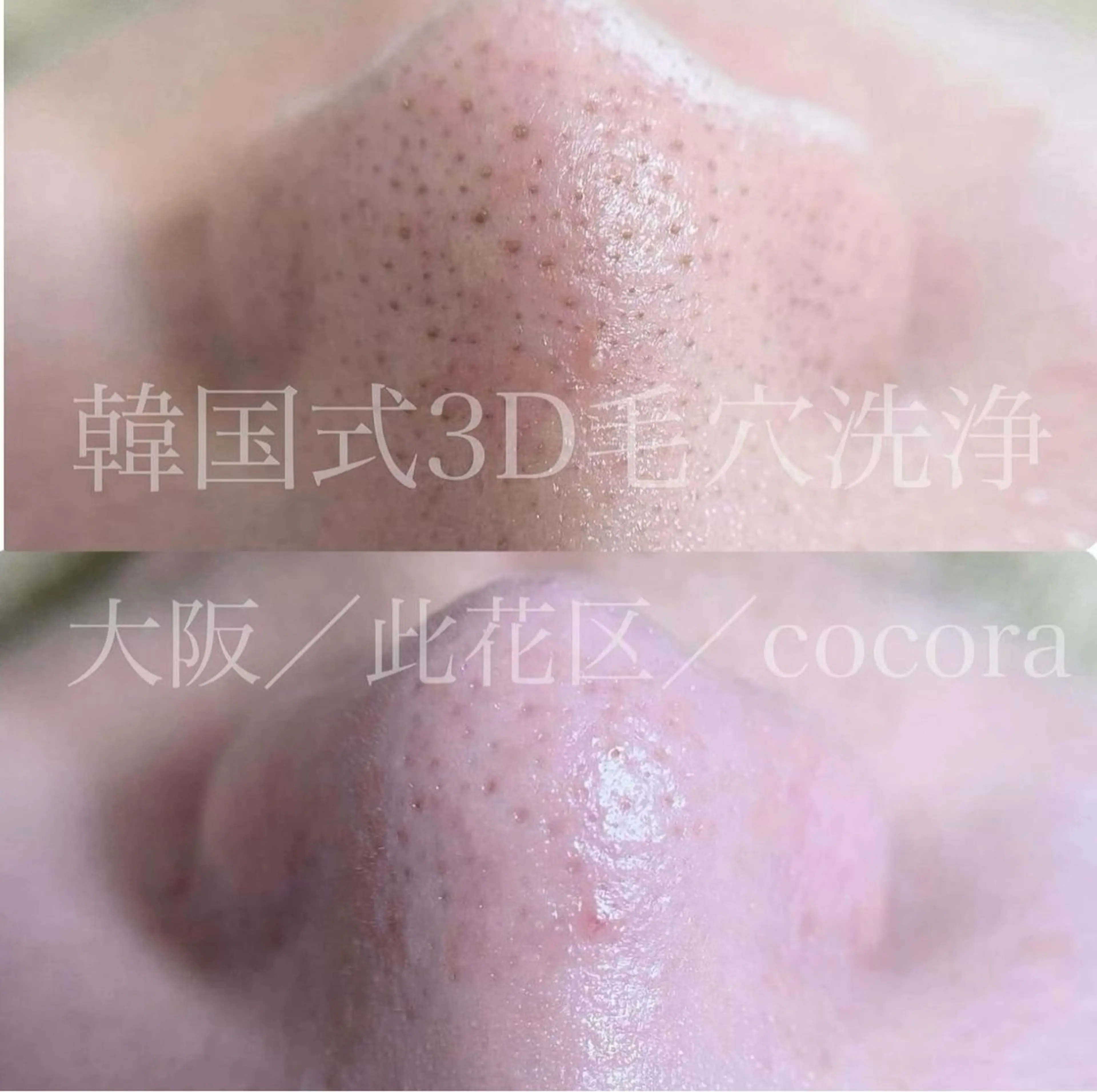 韓国式3D毛穴洗浄 口コミ、LINE登録してくれる方の写真