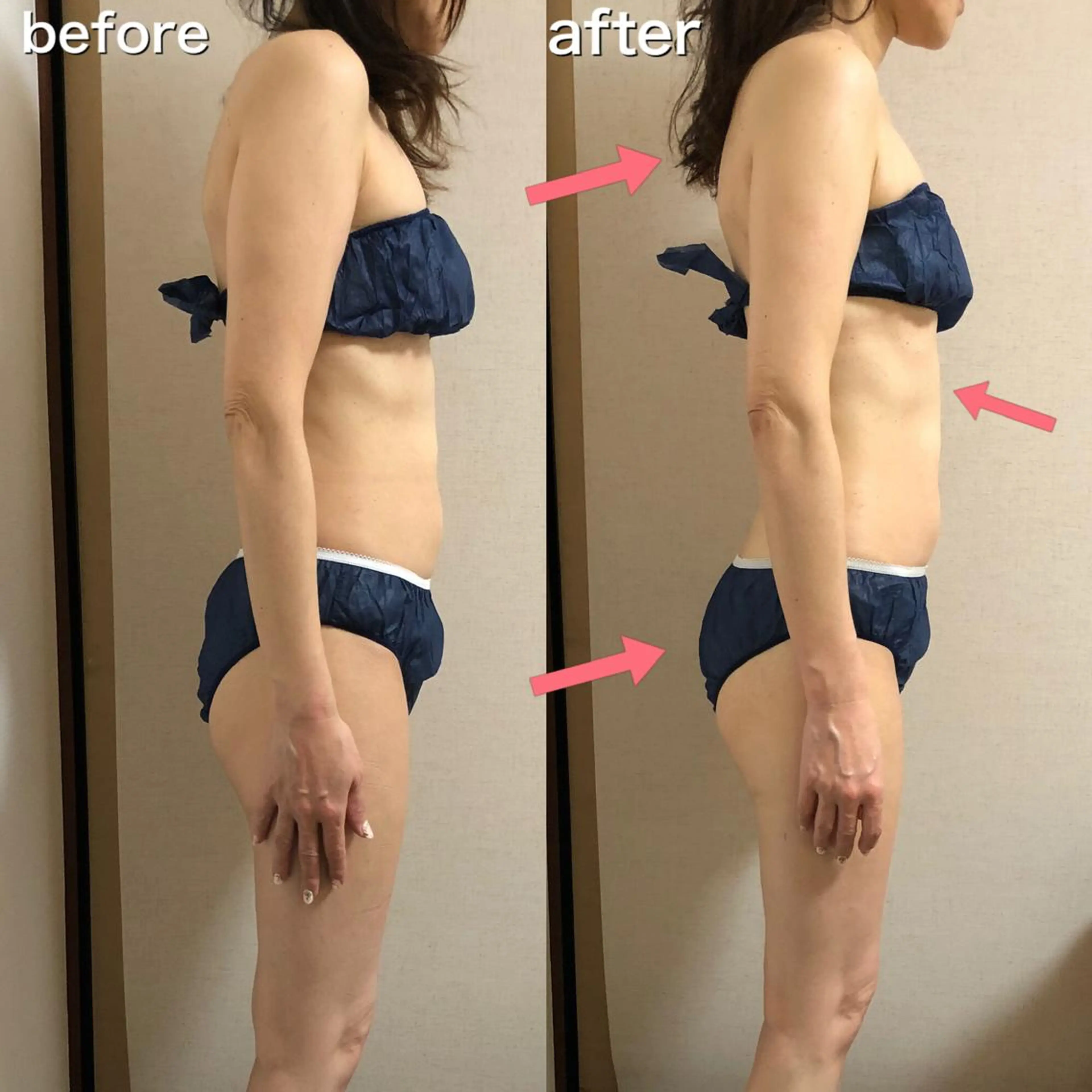 エステ Melia所属・仲田 幸恵のエステ・リラクイメージ